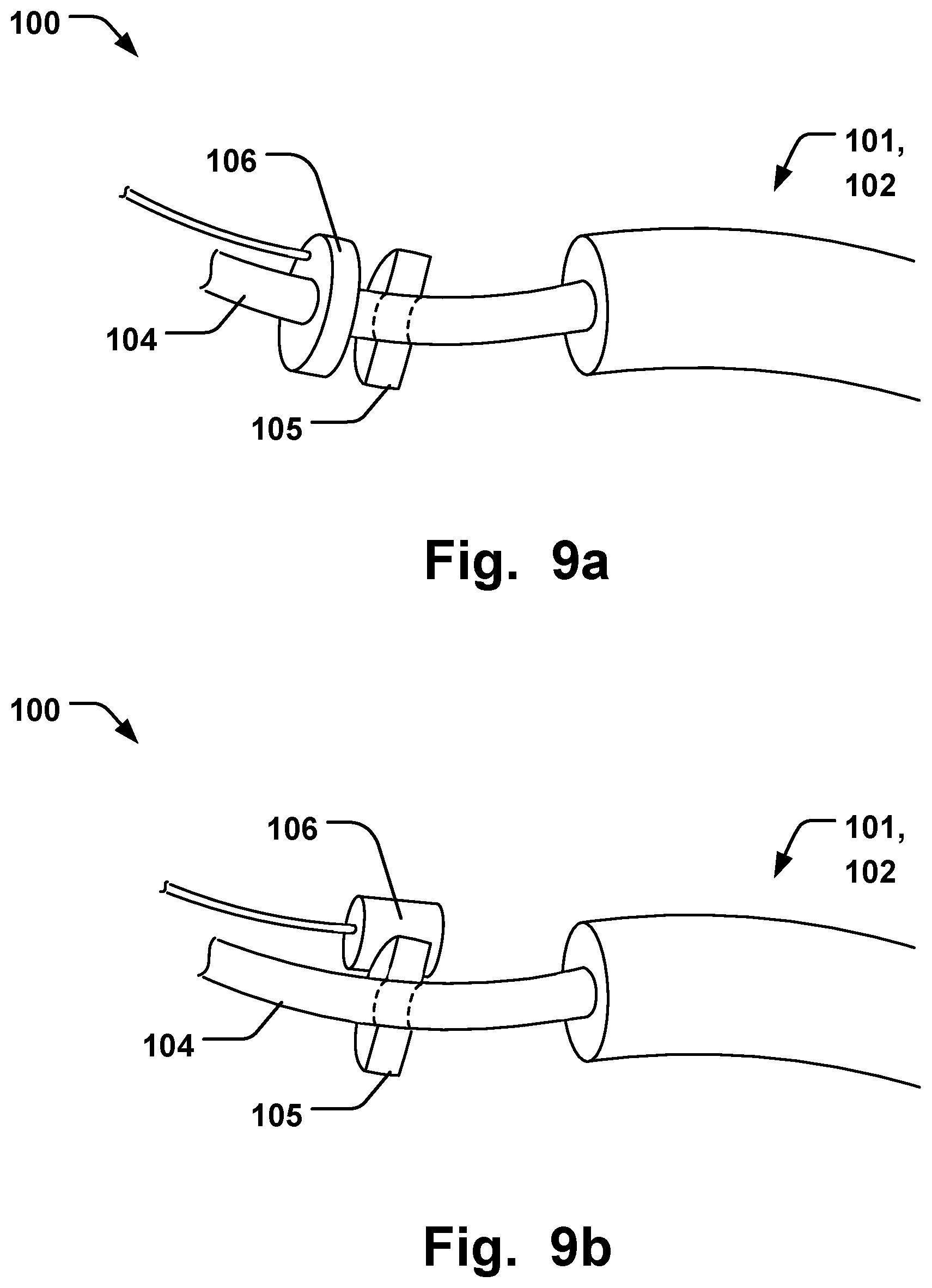 Patent US12564493 Figure 5 – Annuloplasty system