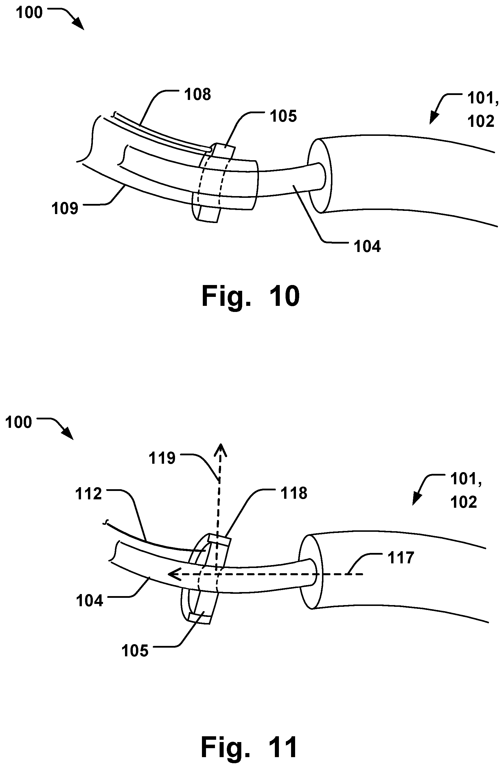Patent US12564493 Figure 6 – Annuloplasty system