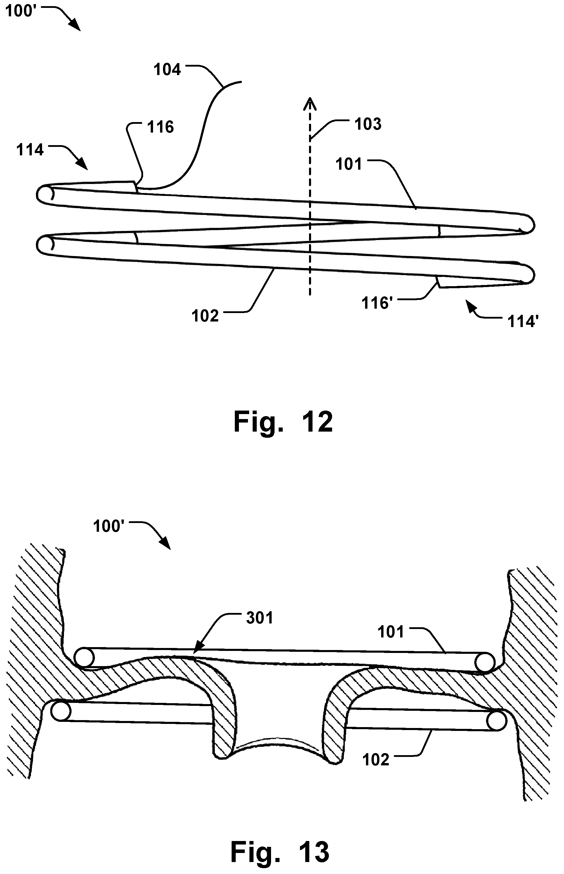 Patent US12564493 Figure 7 – Annuloplasty system