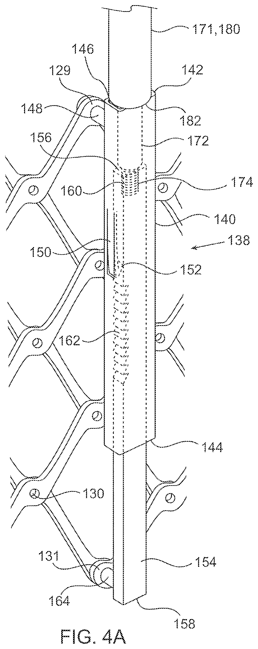 Patent US12564494 Figure 4 – Valves and delivery apparatuses equipped with optic fiber sensors