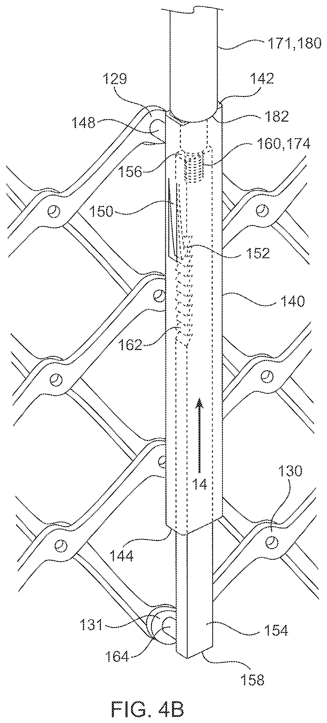 Patent US12564494 Figure 5 – Valves and delivery apparatuses equipped with optic fiber sensors