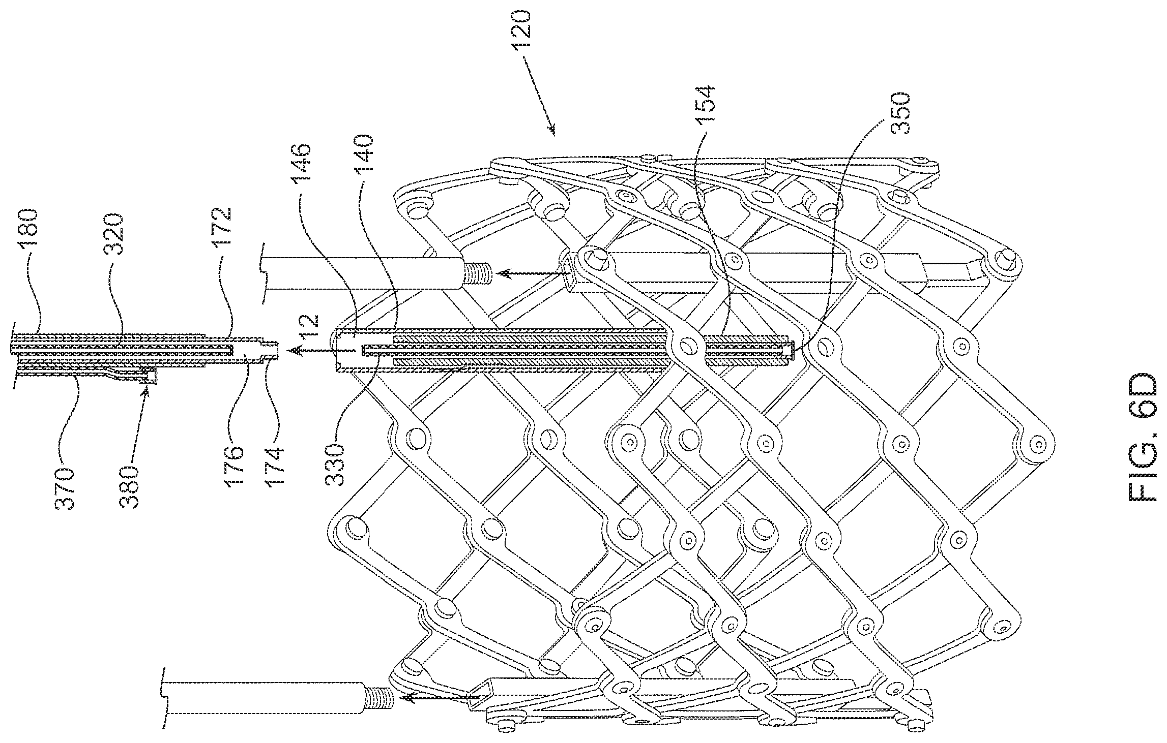 Patent US12564494 Figure 11 – Valves and delivery apparatuses equipped with optic fiber sensors