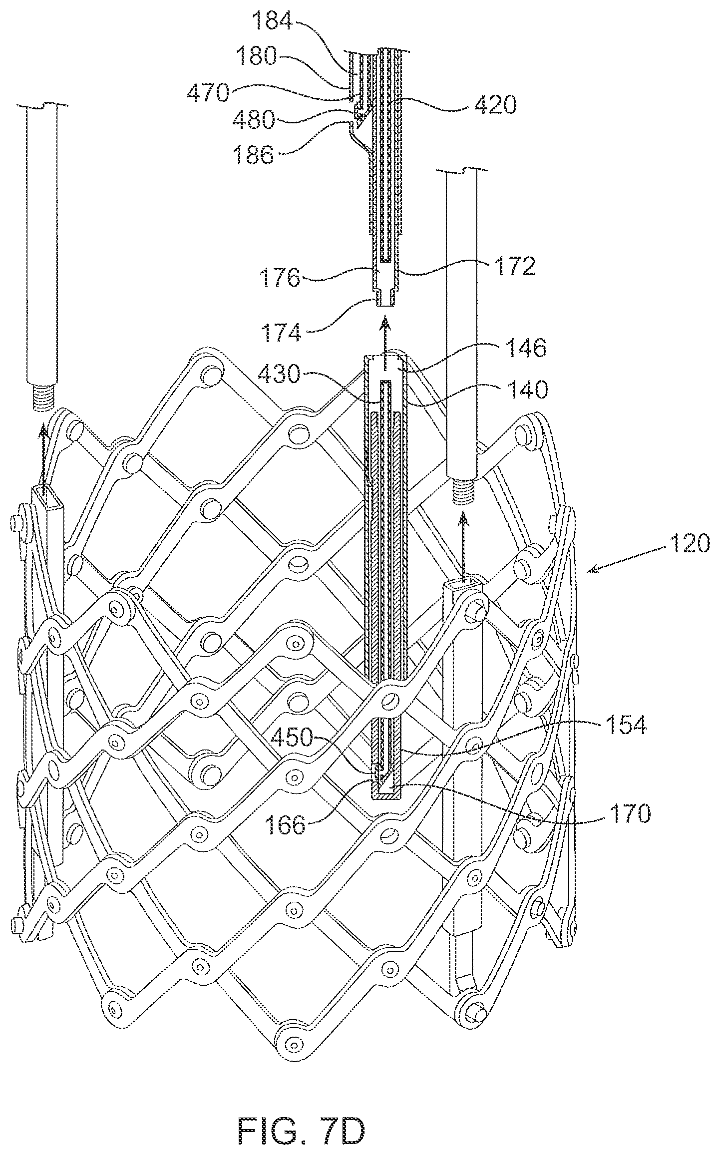 Patent US12564494 Figure 14 – Valves and delivery apparatuses equipped with optic fiber sensors