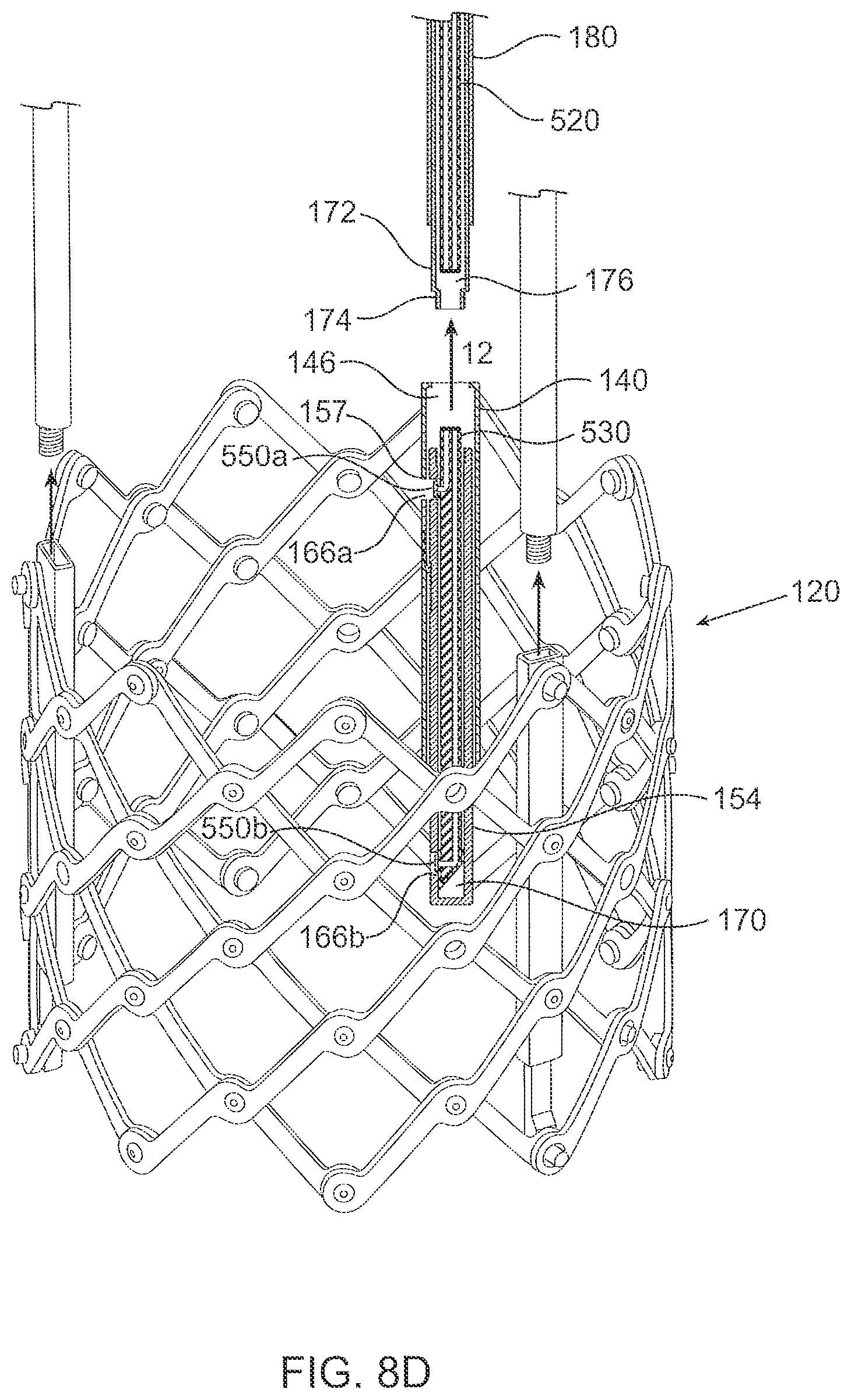 Patent US12564494 Figure 17 – Valves and delivery apparatuses equipped with optic fiber sensors