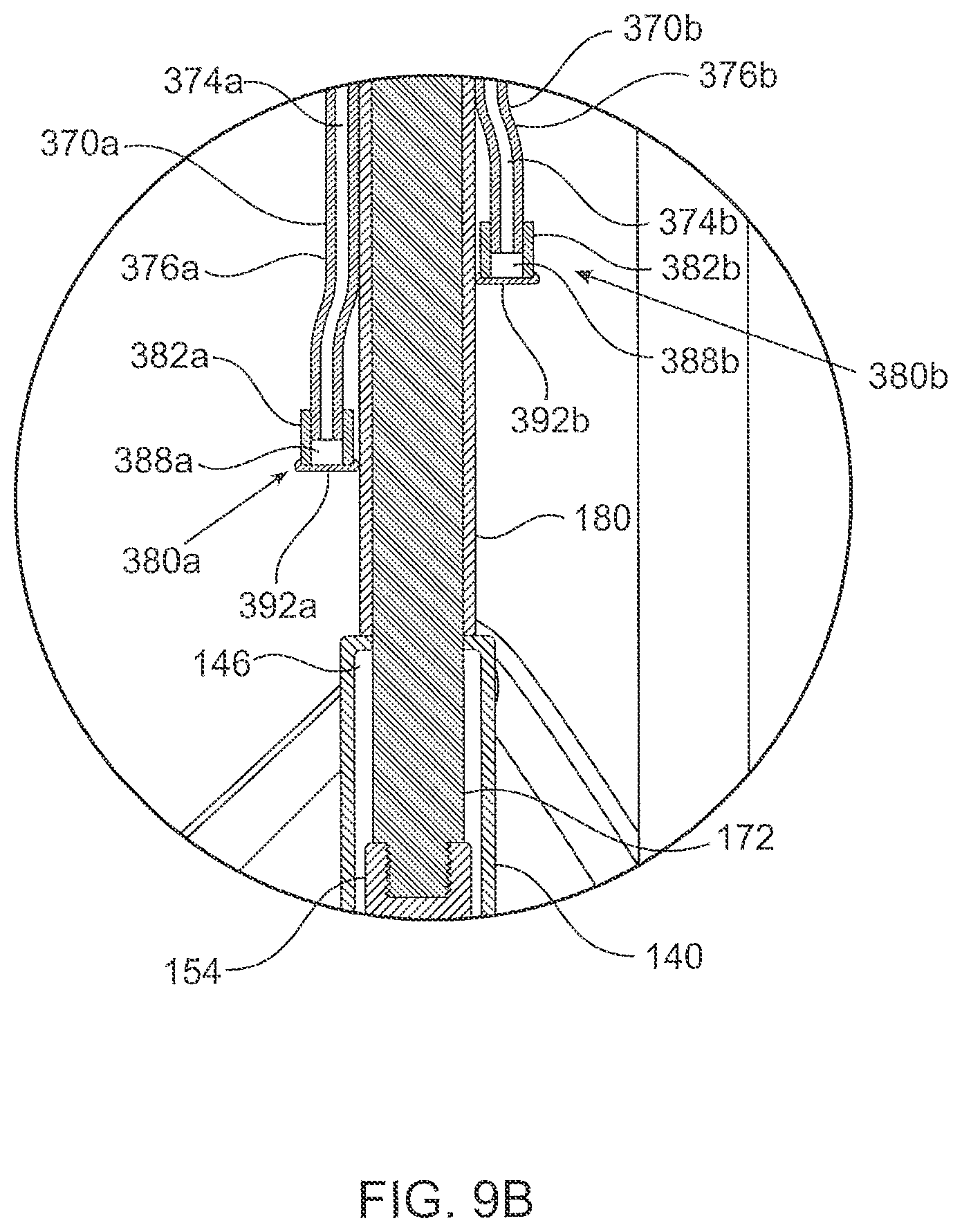 Patent US12564494 Figure 19 – Valves and delivery apparatuses equipped with optic fiber sensors