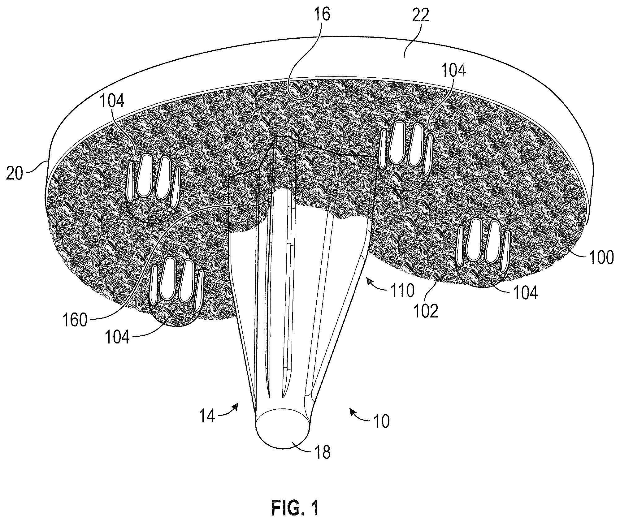 Patent US12564496 Figure 1 – Hybrid fixation features for three-dimensional porous structures for bone ingrowth and methods for producing