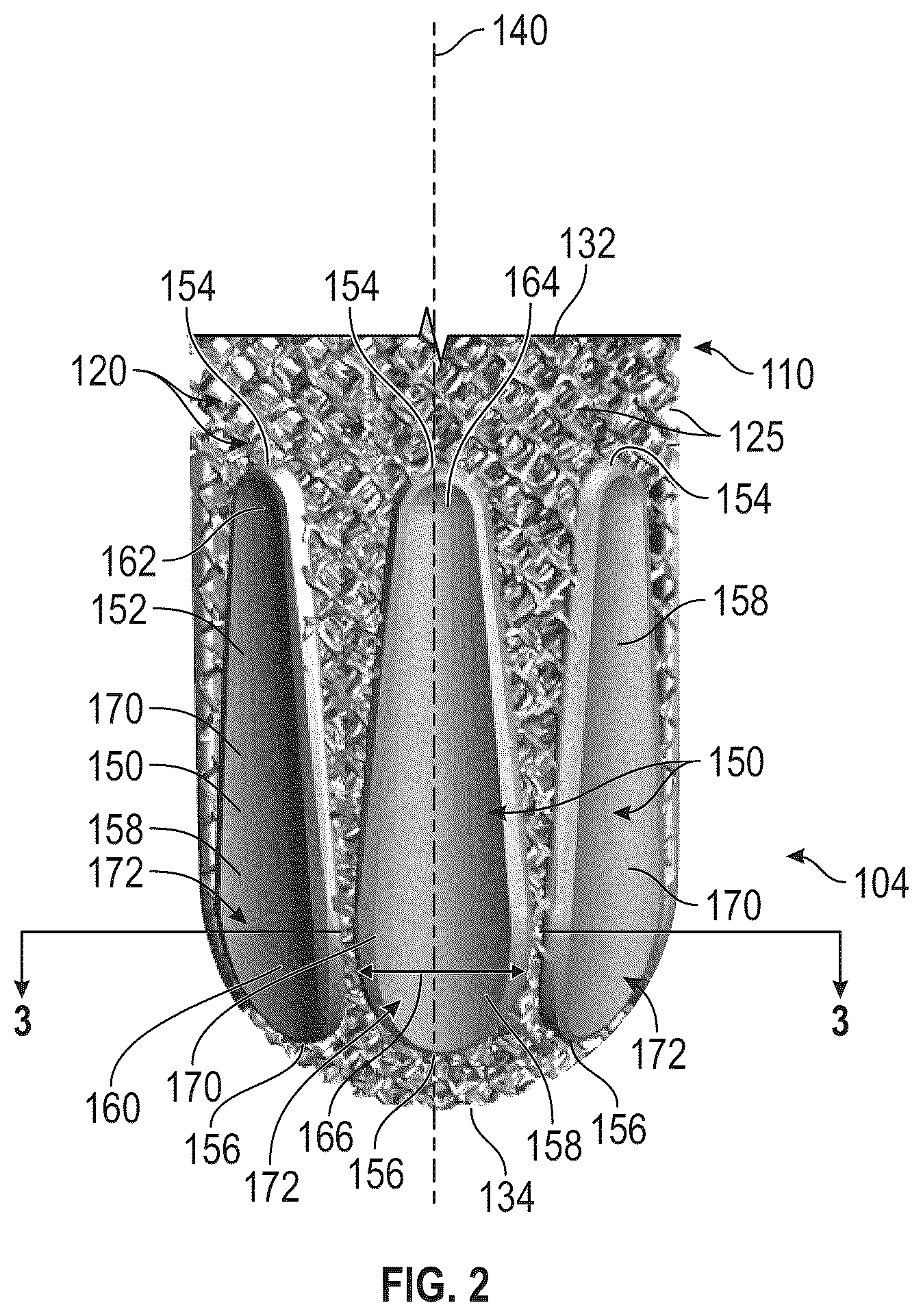 Patent US12564496 Figure 2 – Hybrid fixation features for three-dimensional porous structures for bone ingrowth and methods for producing