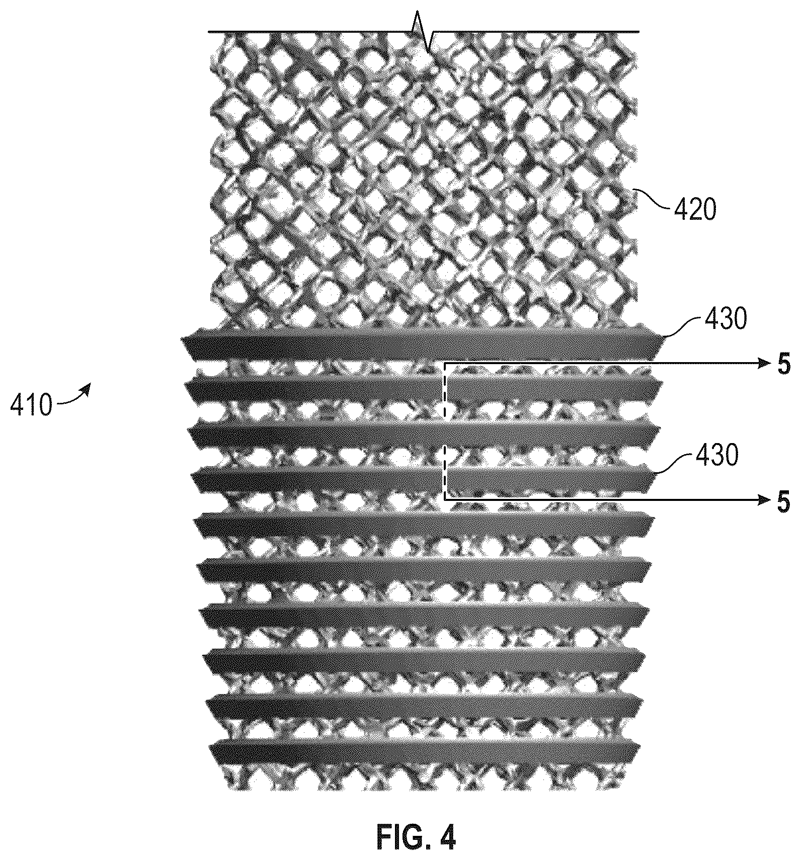 Patent US12564496 Figure 4 – Hybrid fixation features for three-dimensional porous structures for bone ingrowth and methods for producing
