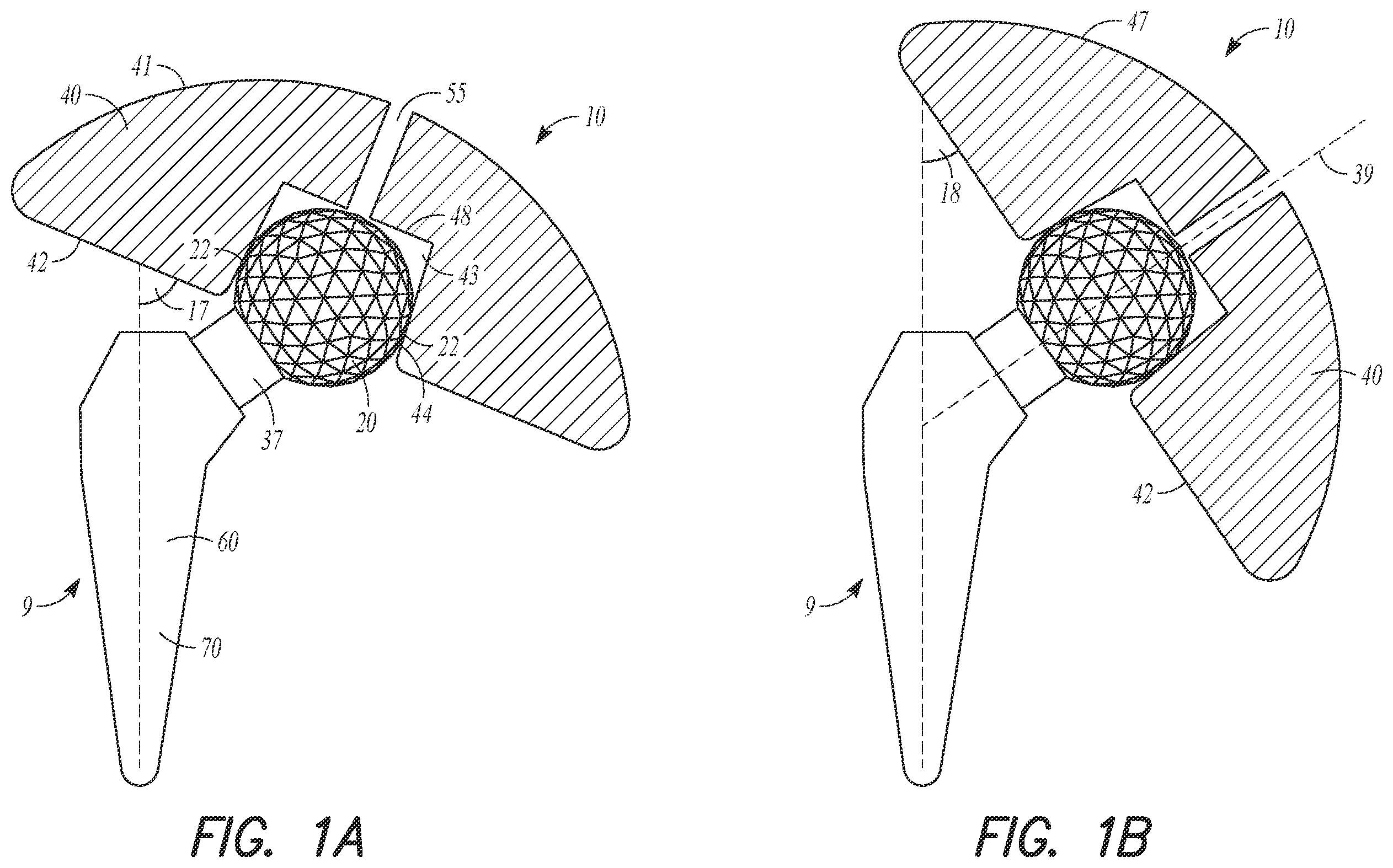 Patent US12564497 — Adjustable orthopedic connections — Figure 1