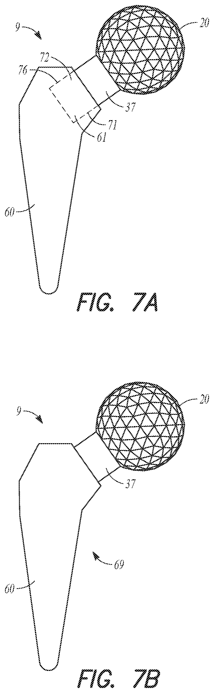 Patent US12564497 Figure 8 – Adjustable orthopedic connections