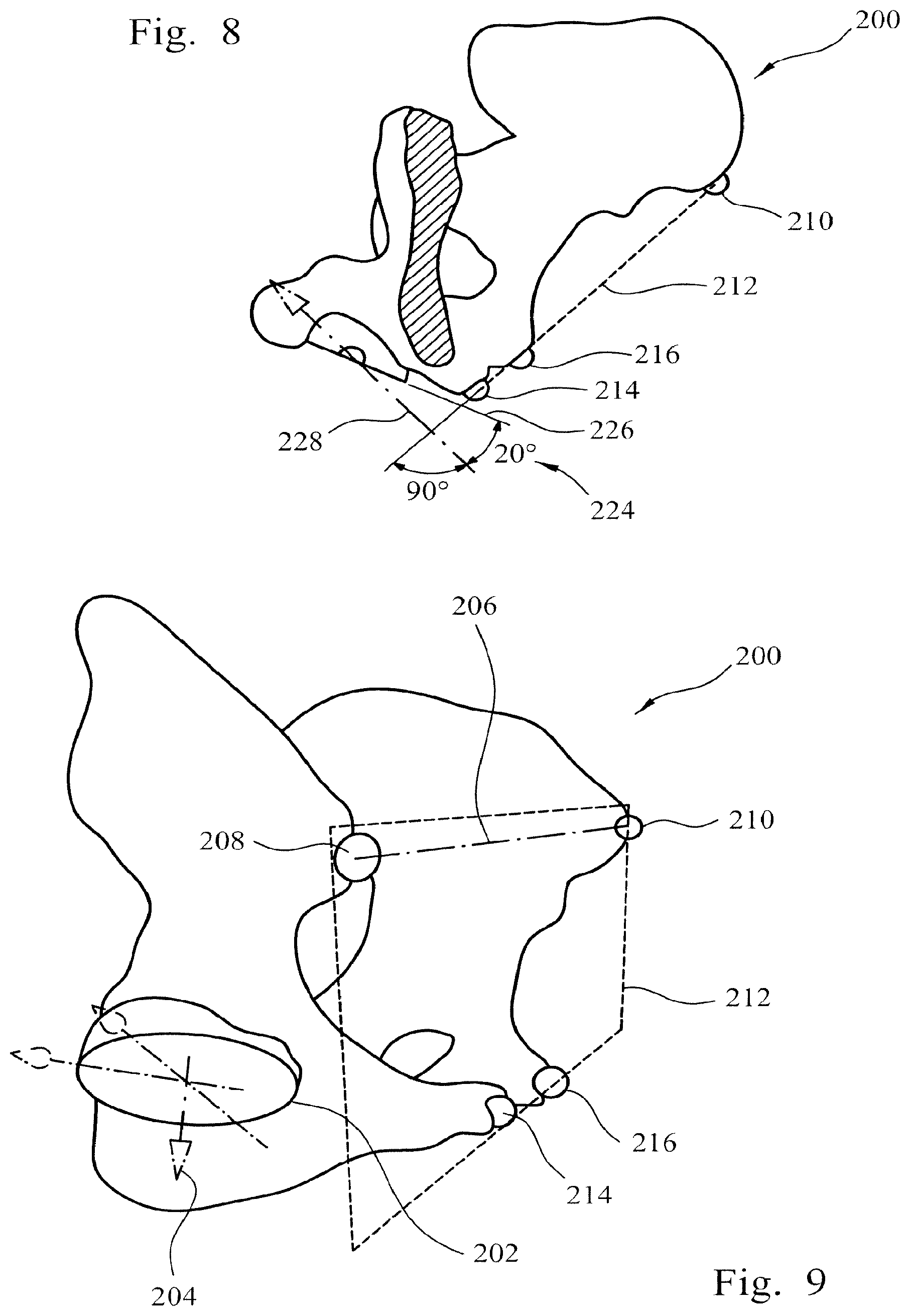 Patent US12564500 Figure 4 – Femoral trialling kit and assembly