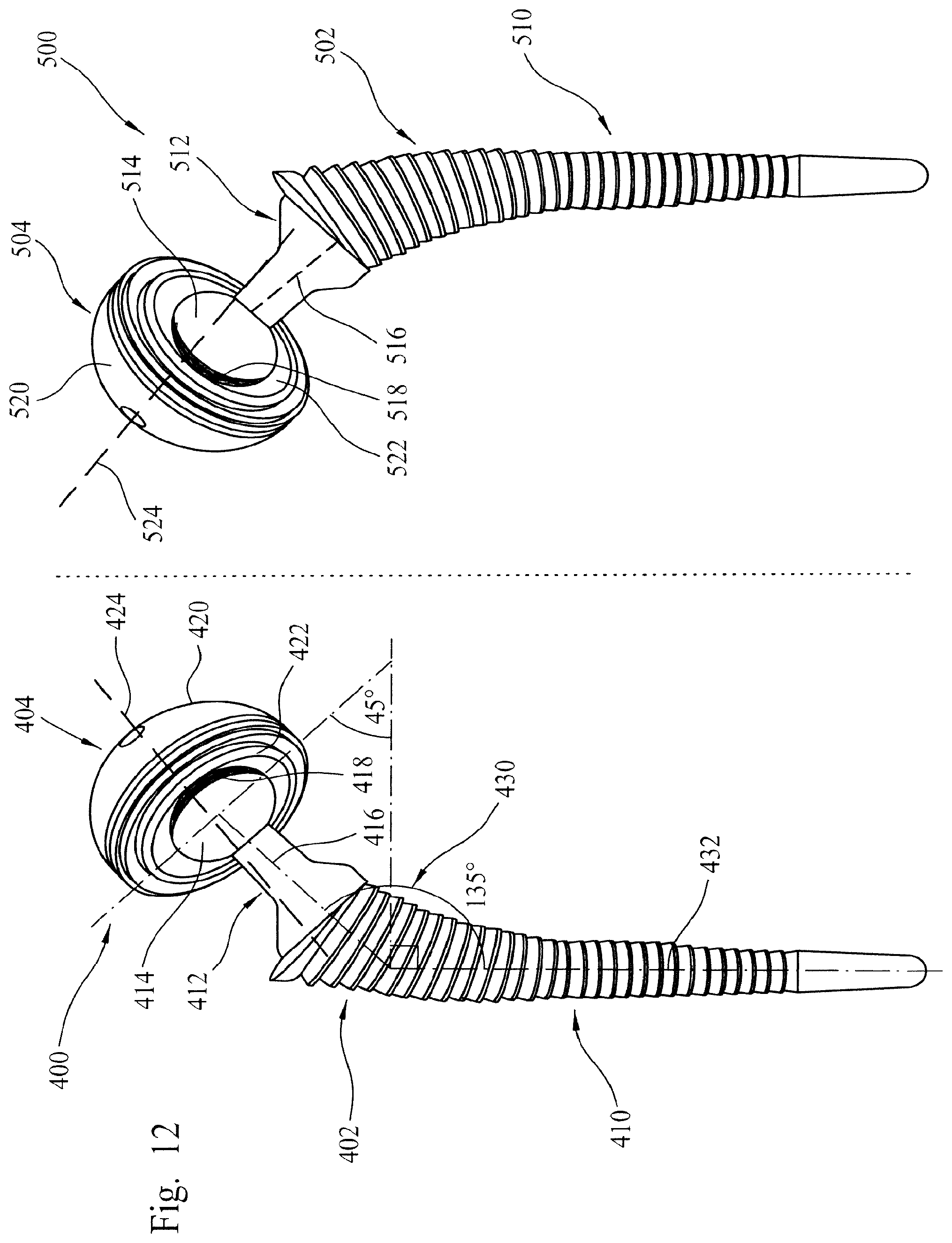 Patent US12564500 Figure 7 – Femoral trialling kit and assembly