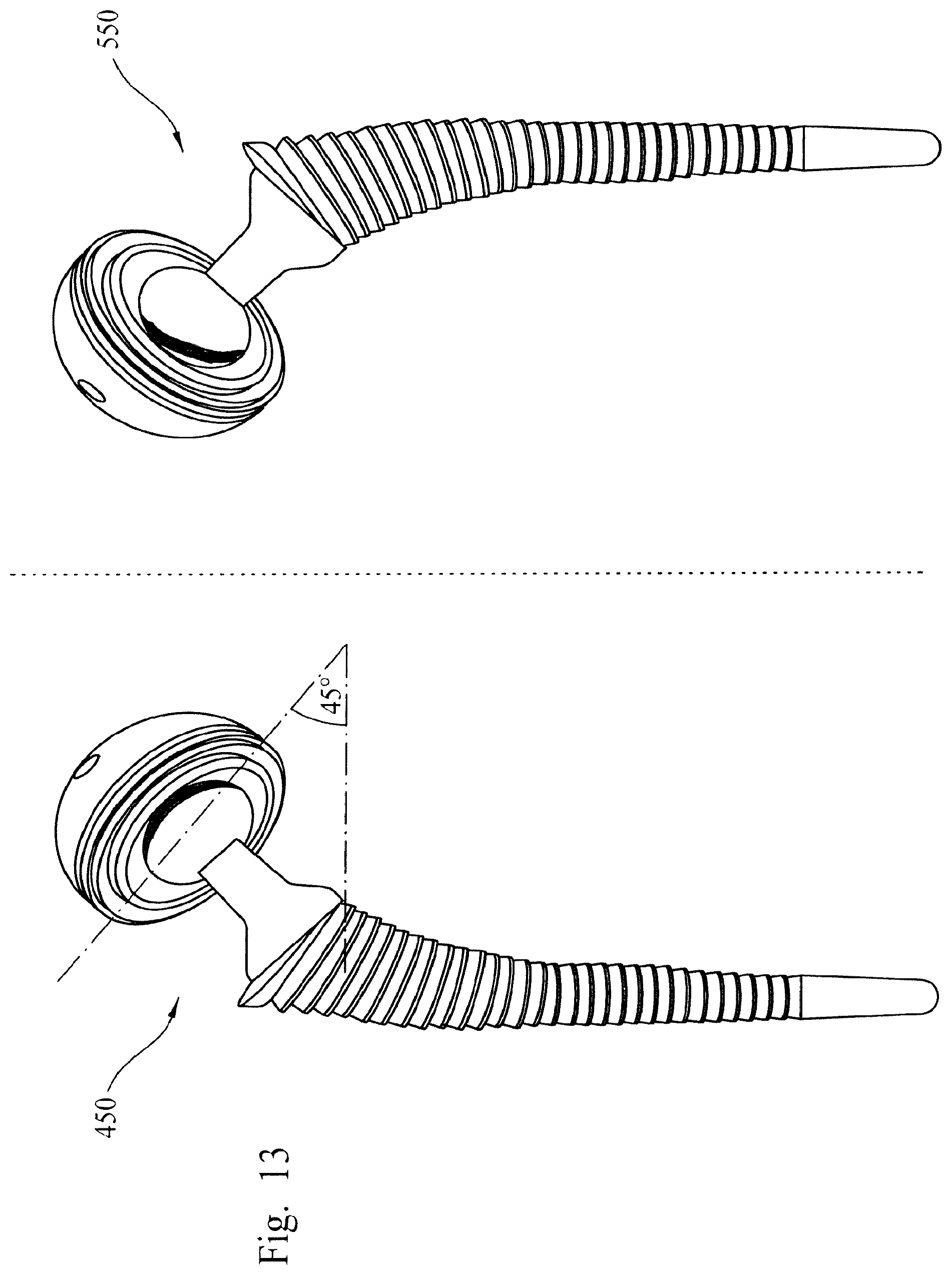 Patent US12564500 Figure 8 – Femoral trialling kit and assembly