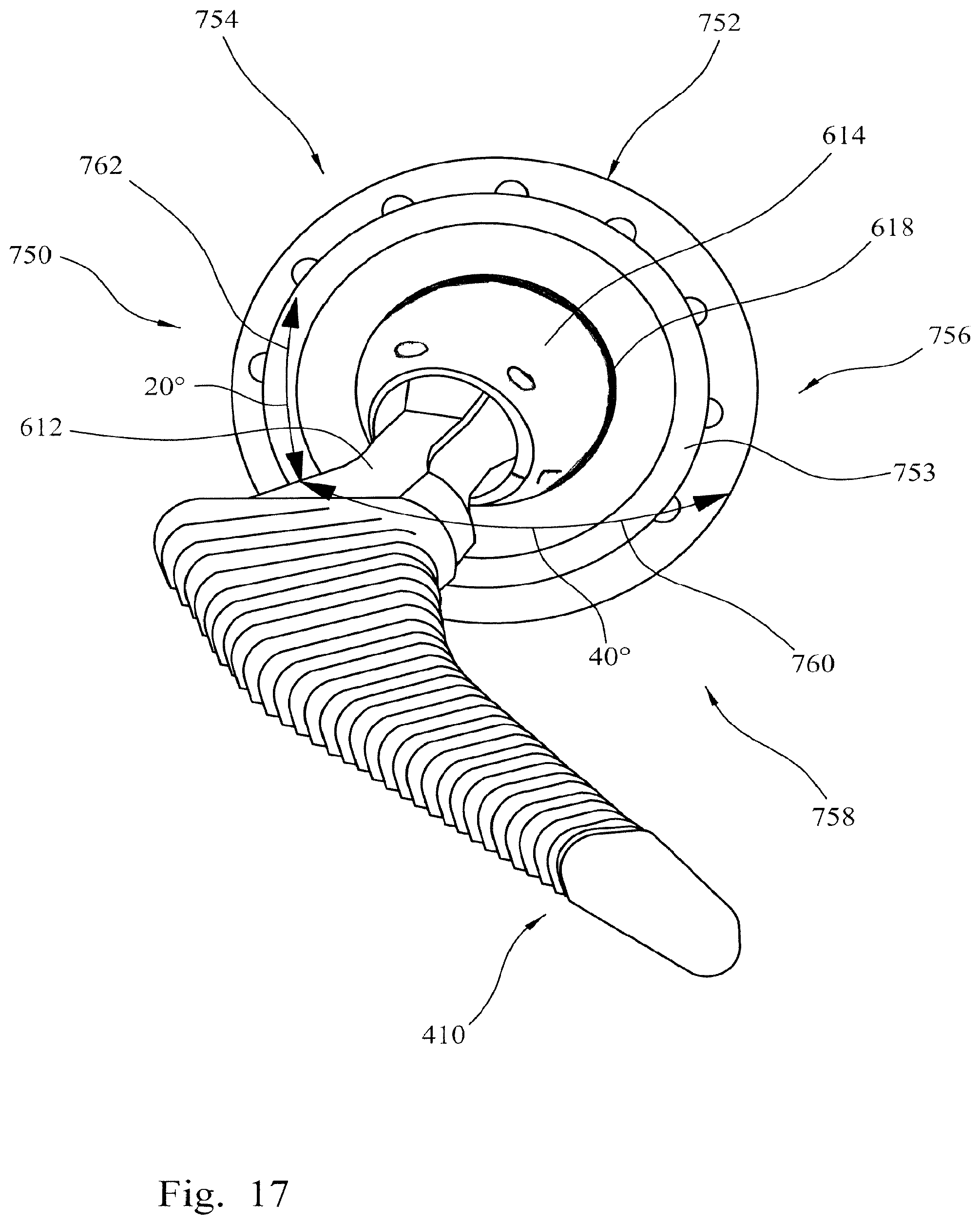 Patent US12564500 Figure 12 – Femoral trialling kit and assembly