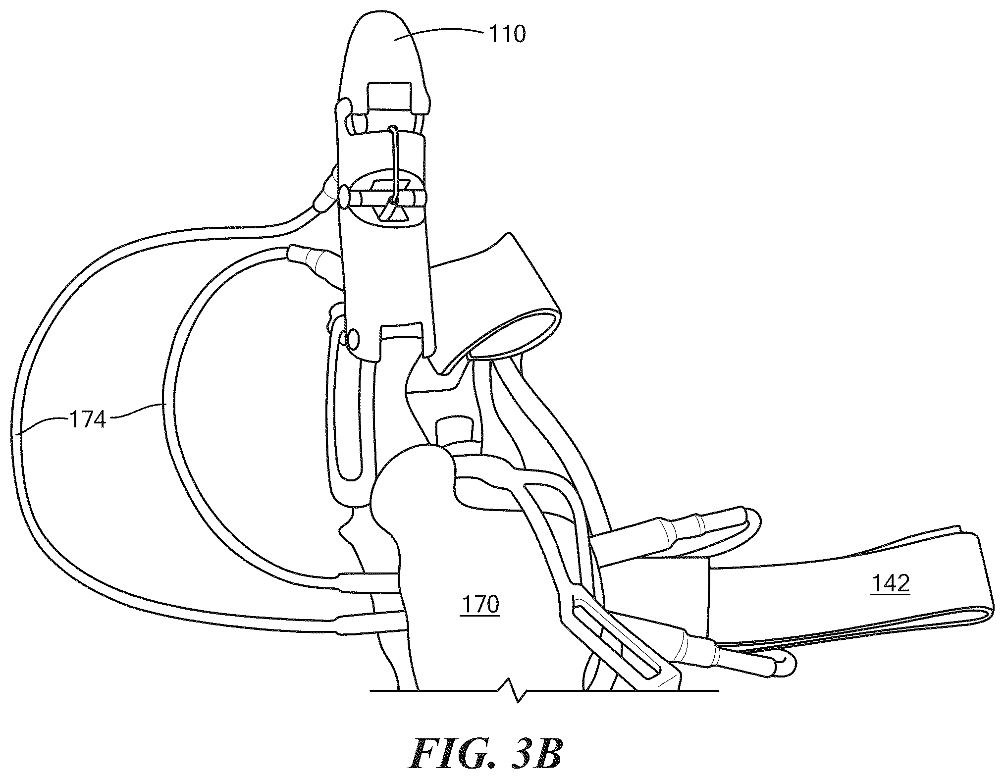 Patent US12564501 Figure 4 – Partial hand prosthesis