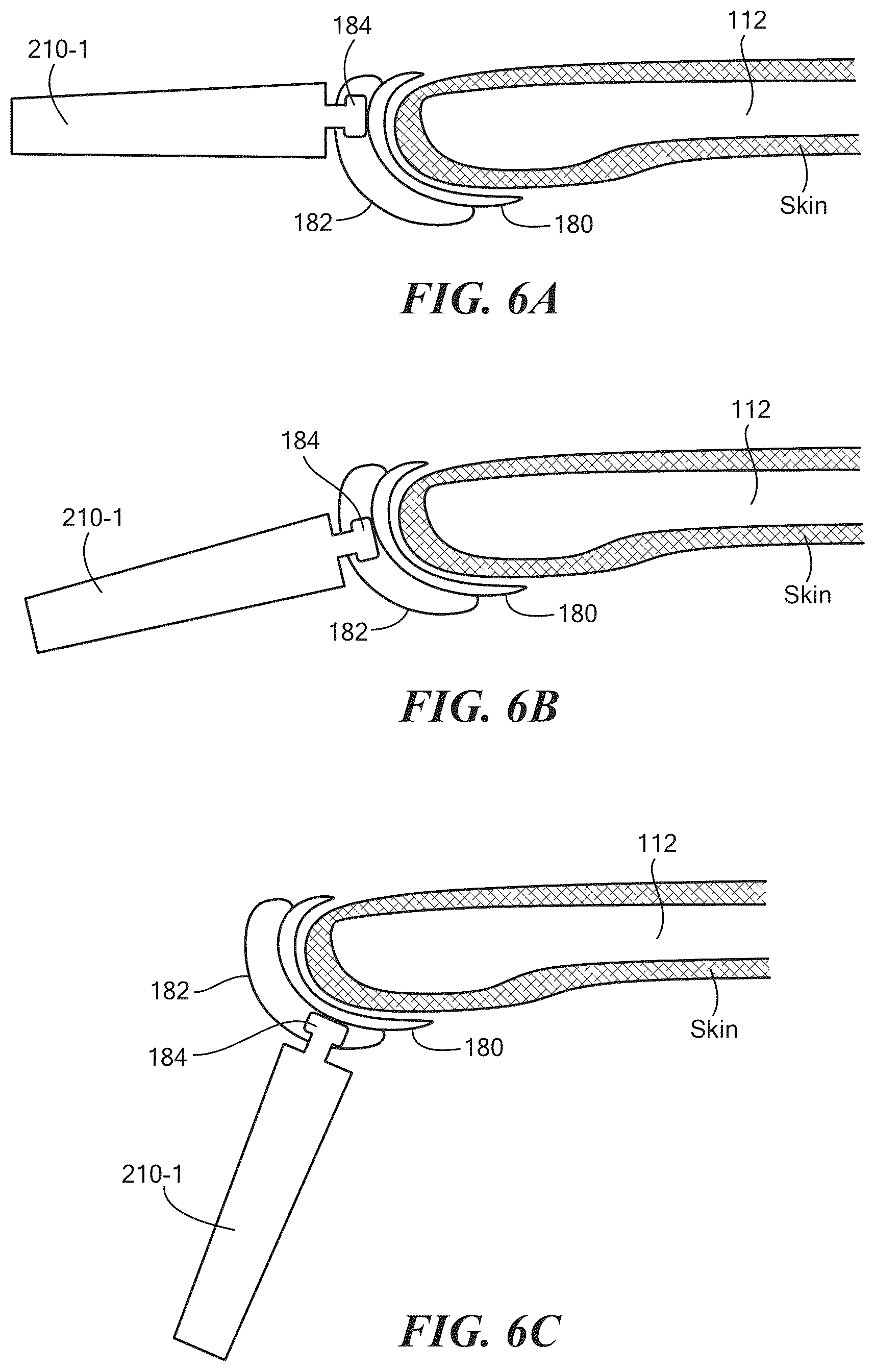 Patent US12564501 Figure 8 – Partial hand prosthesis