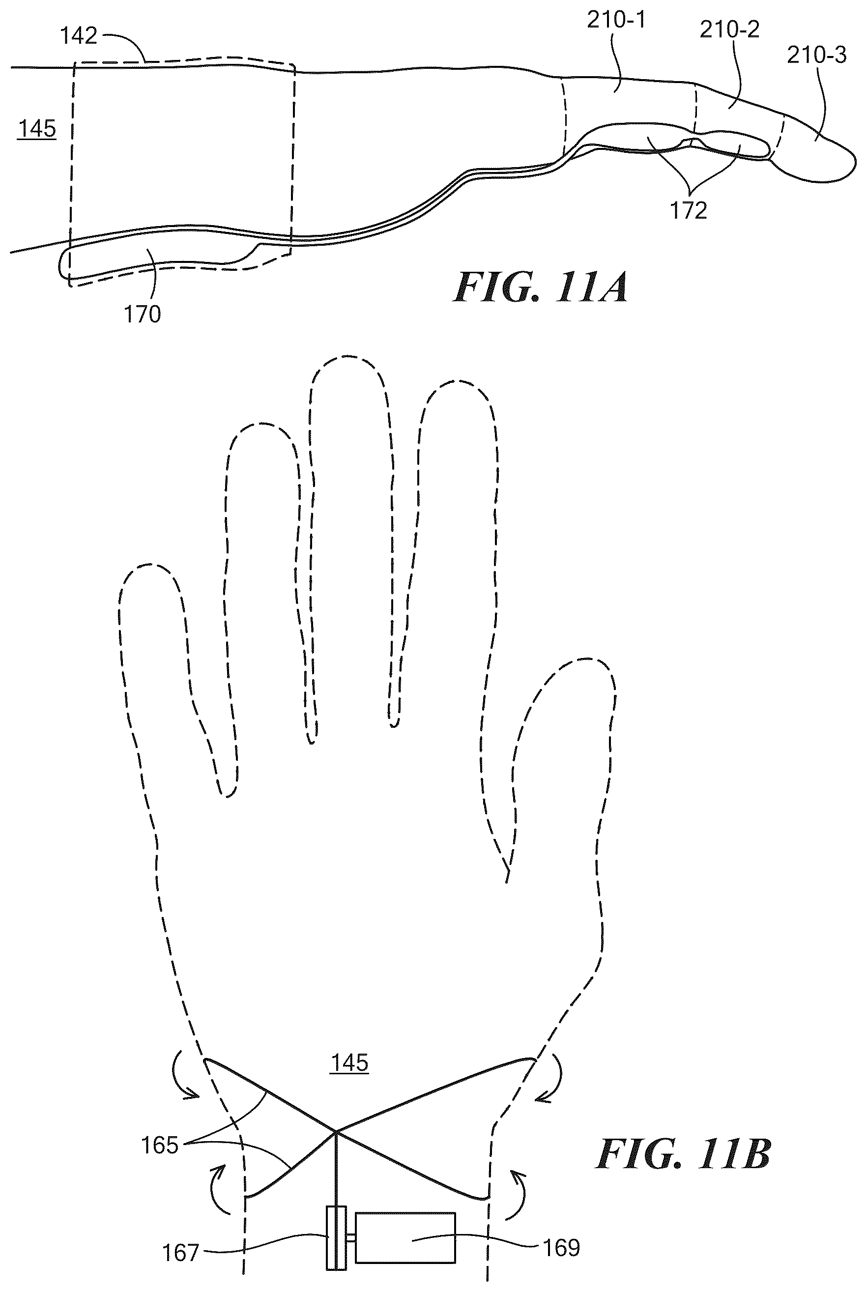 Patent US12564501 Figure 15 – Partial hand prosthesis