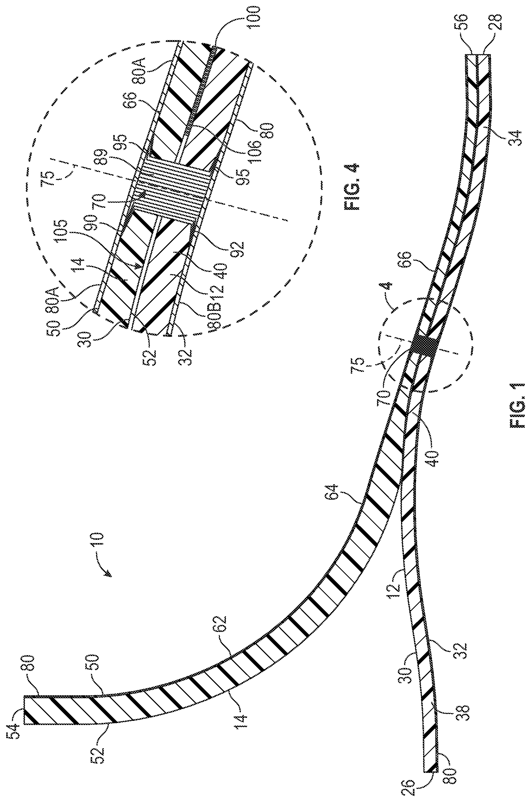 Patent US12564502 Figure 1 – Prosthetic foot
