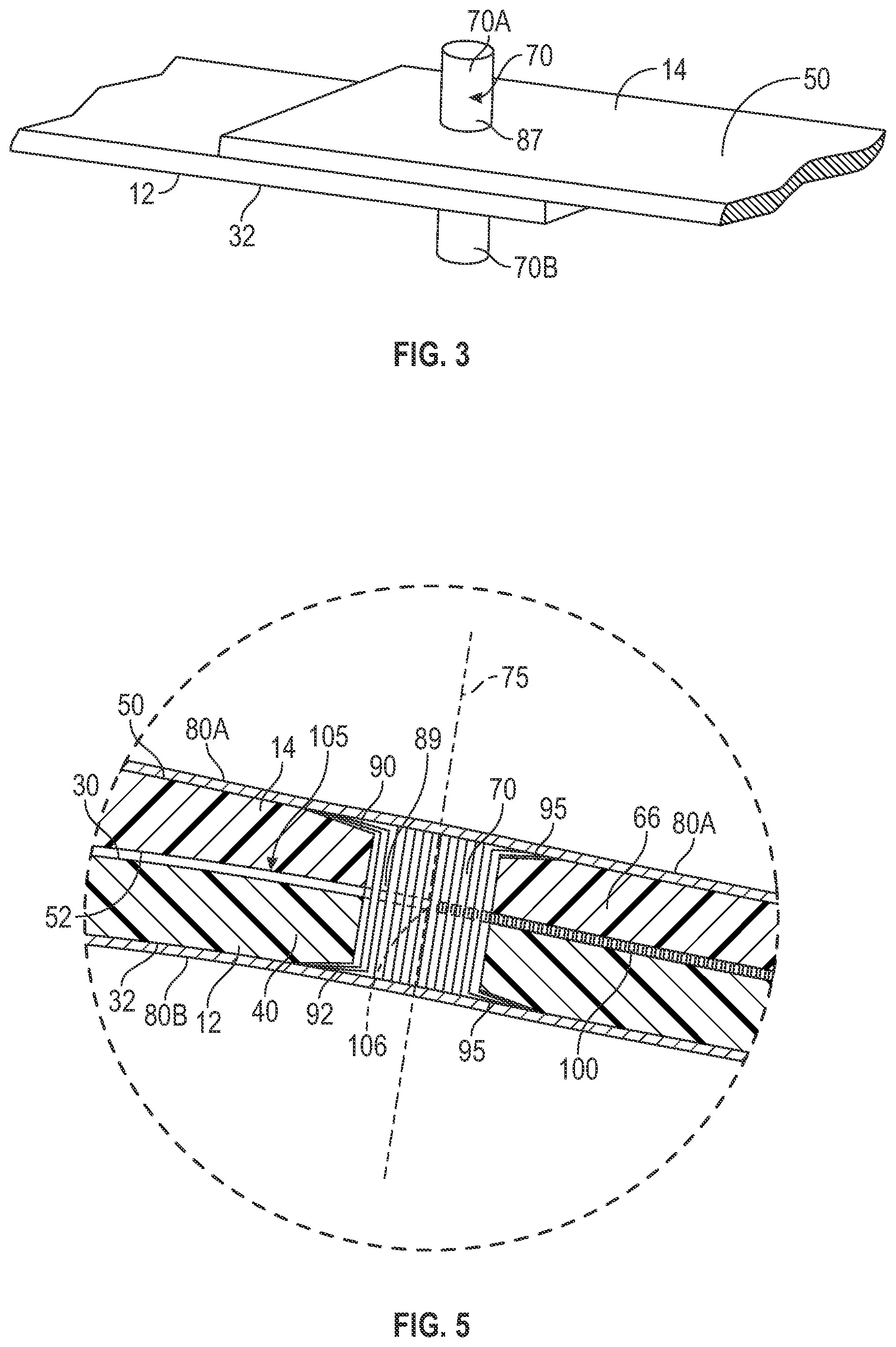 Patent US12564502 Figure 3 – Prosthetic foot