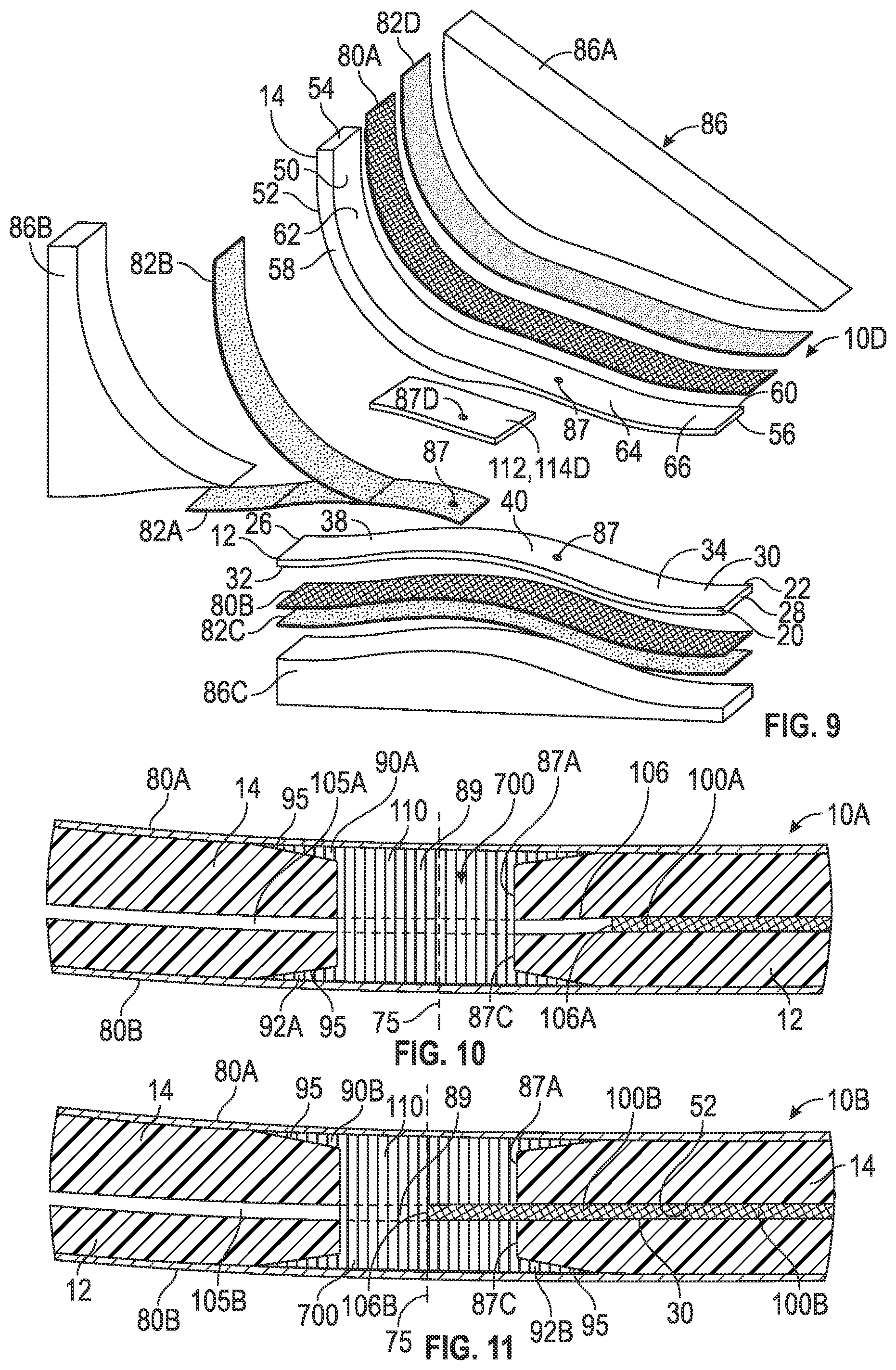 Patent US12564502 Figure 7 – Prosthetic foot