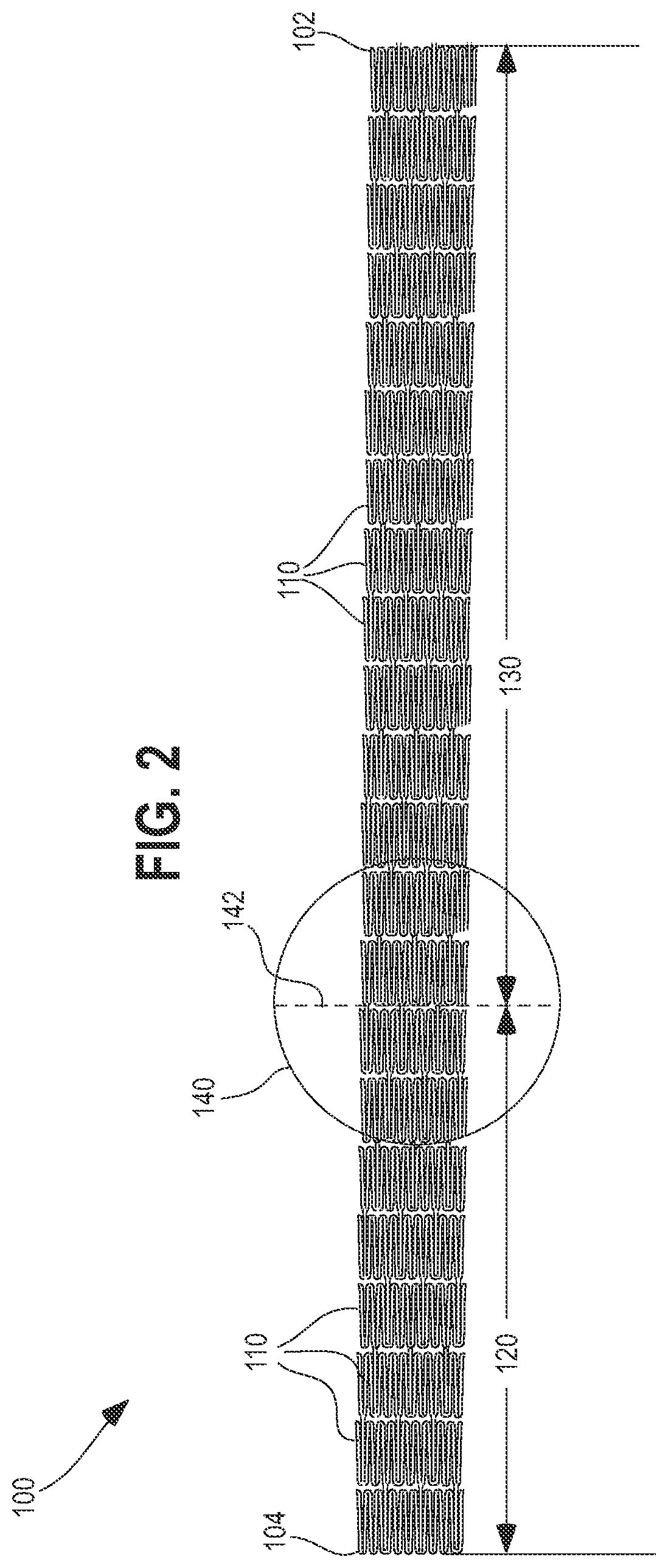 Patent US12564504 Figure 2 – Method and system for delivering a self-expanding stent to the venous sinuses