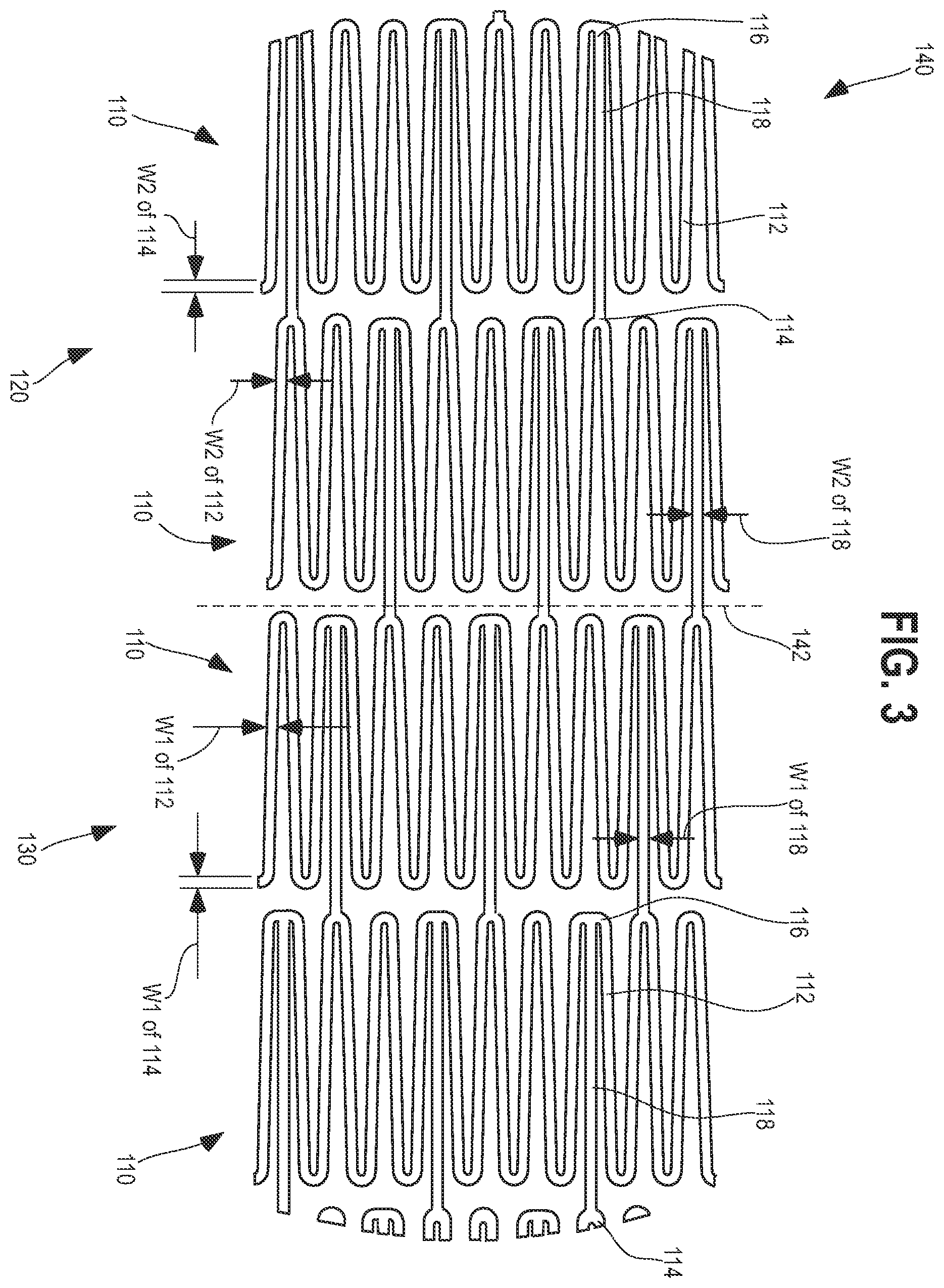 Patent US12564504 Figure 3 – Method and system for delivering a self-expanding stent to the venous sinuses