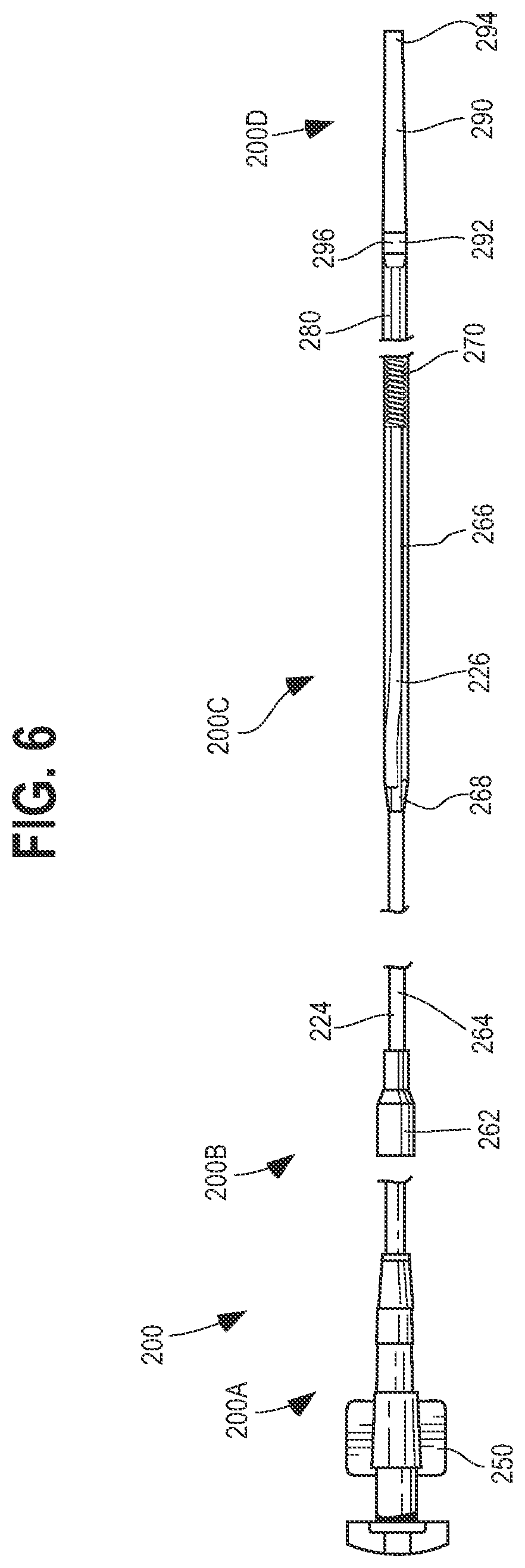 Patent US12564504 Figure 6 – Method and system for delivering a self-expanding stent to the venous sinuses