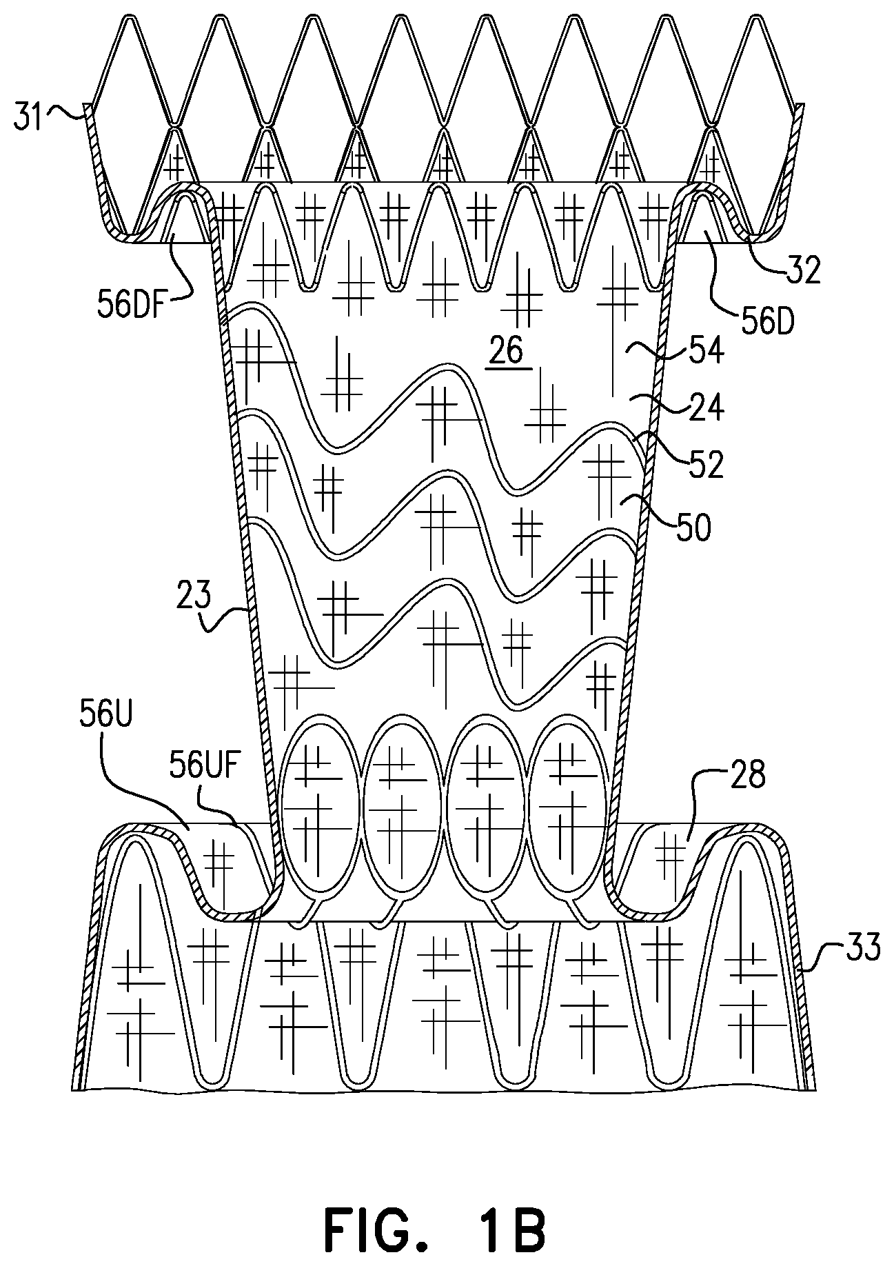 Patent US12564505 Figure 2 – Aortic pressure loss reduction apparatus and methods