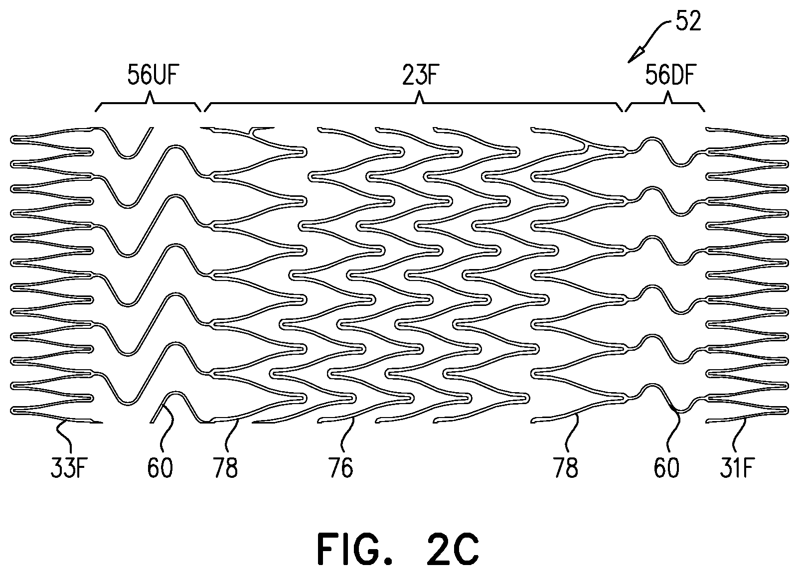Patent US12564505 Figure 4 – Aortic pressure loss reduction apparatus and methods