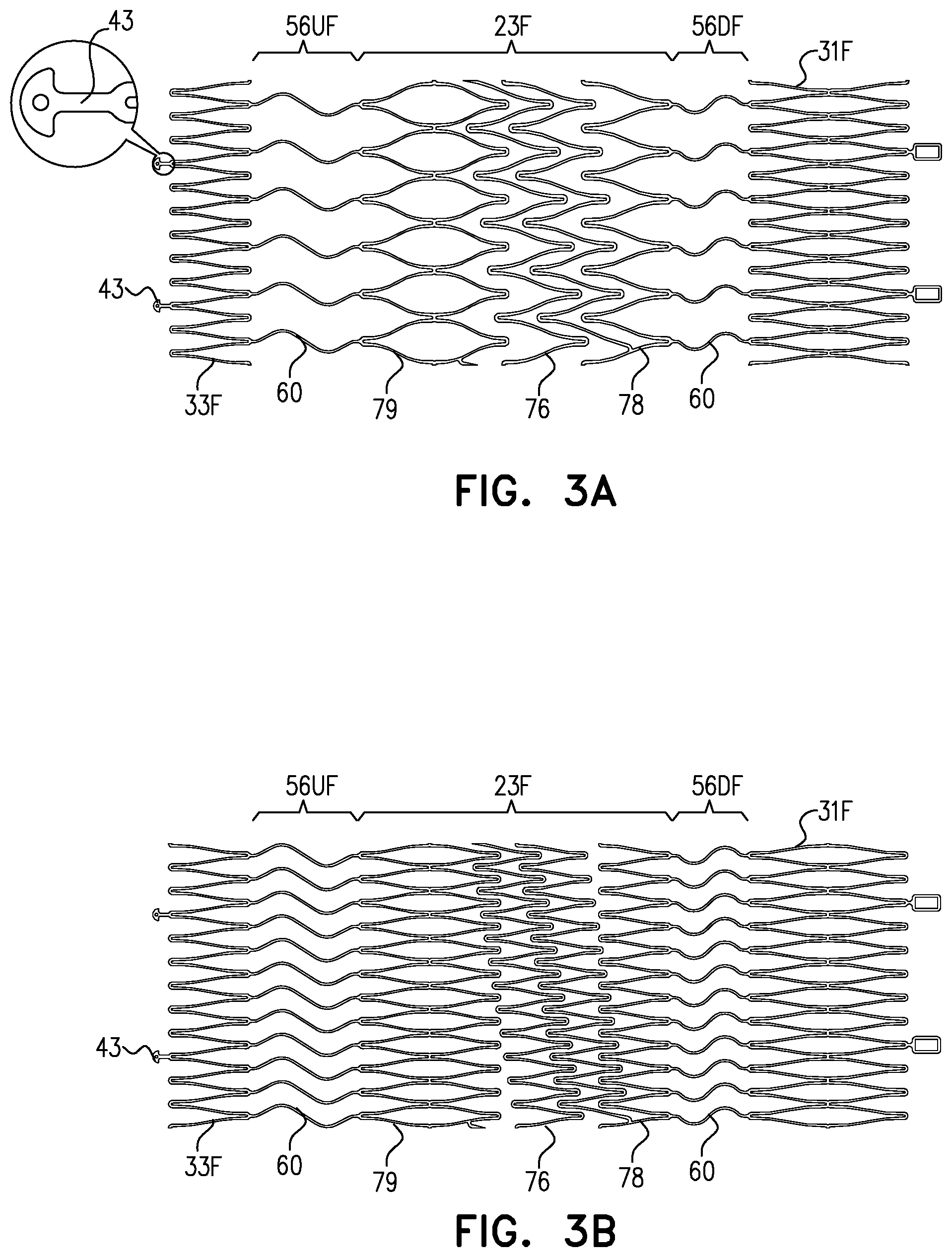 Patent US12564505 Figure 5 – Aortic pressure loss reduction apparatus and methods
