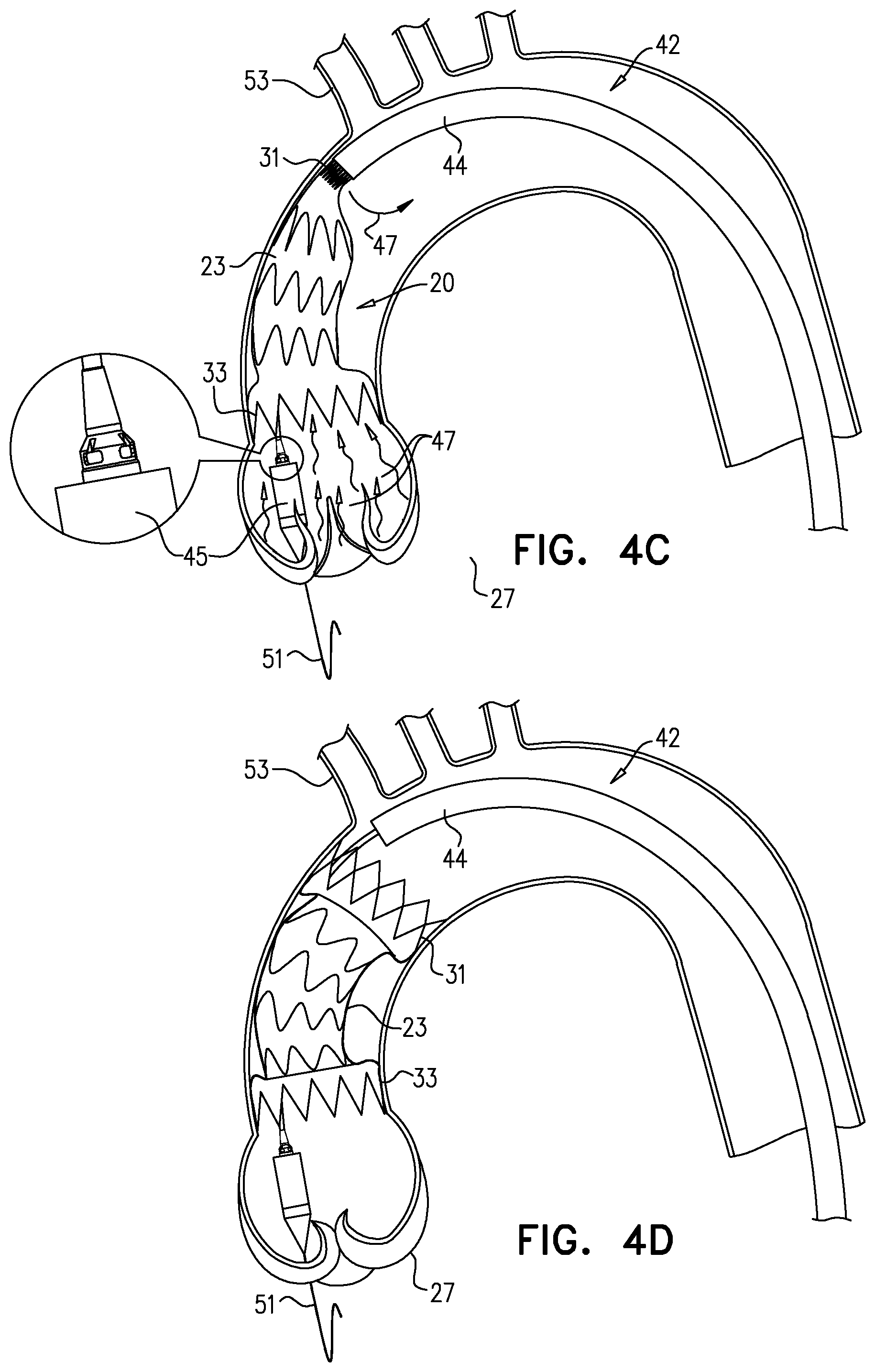Patent US12564505 Figure 7 – Aortic pressure loss reduction apparatus and methods
