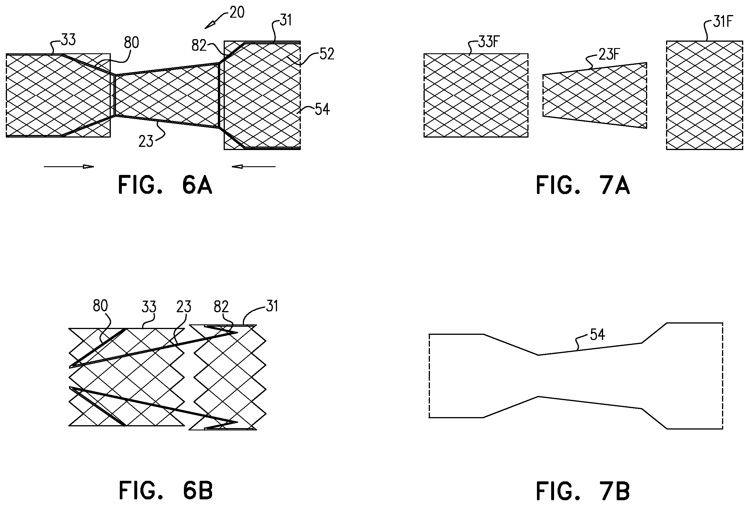 Patent US12564505 Figure 10 – Aortic pressure loss reduction apparatus and methods