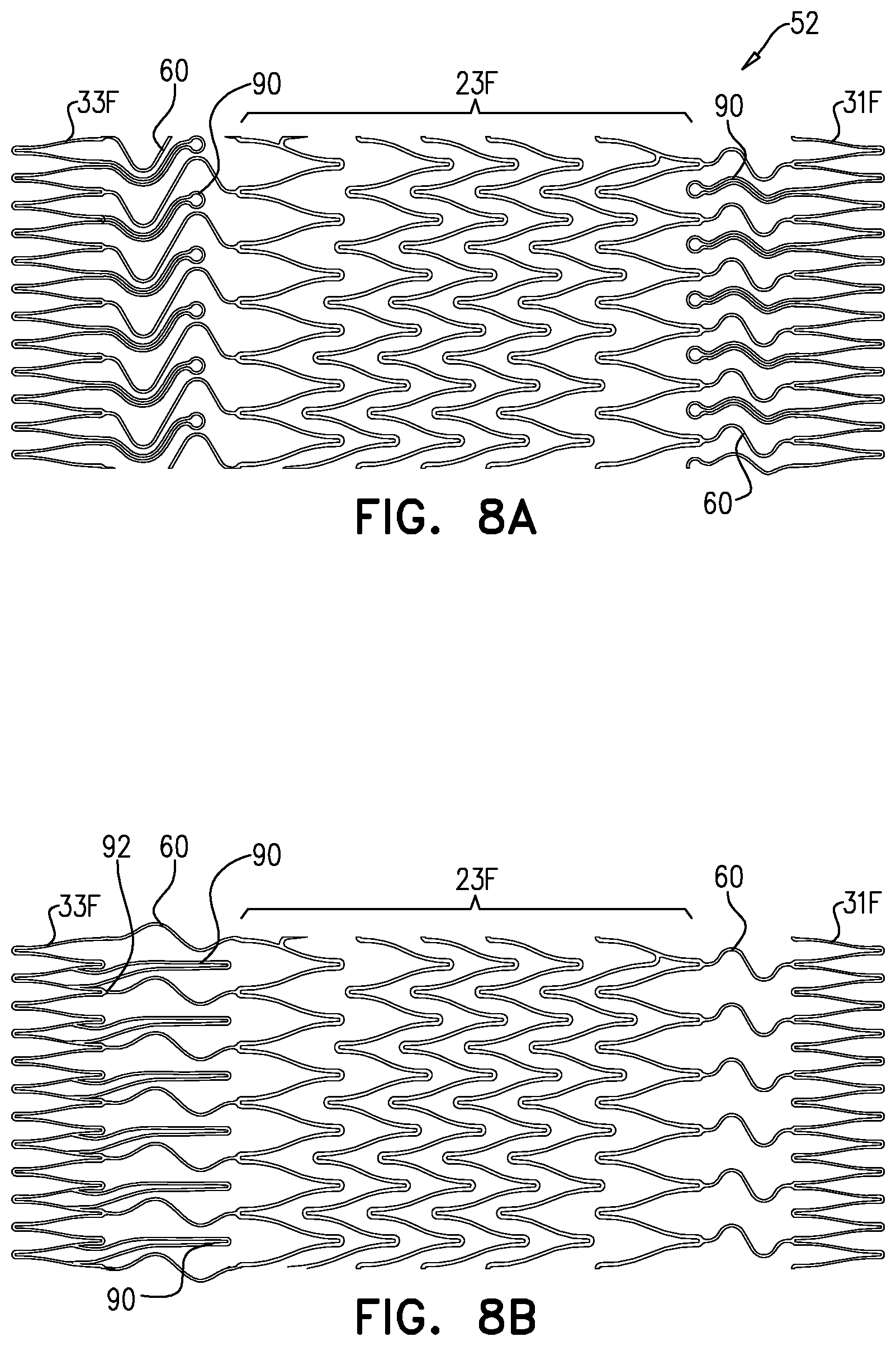Patent US12564505 Figure 11 – Aortic pressure loss reduction apparatus and methods