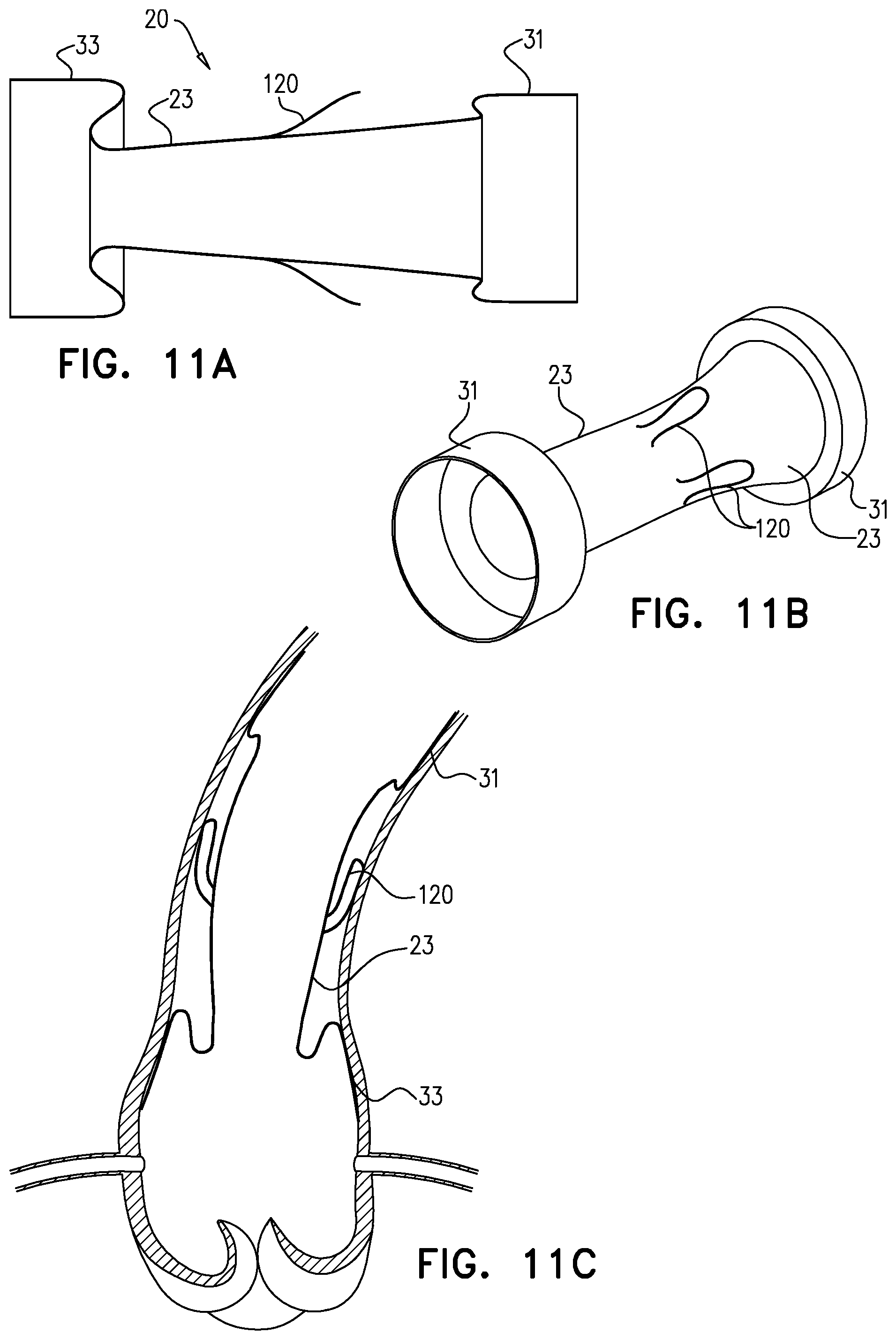 Patent US12564505 Figure 15 – Aortic pressure loss reduction apparatus and methods