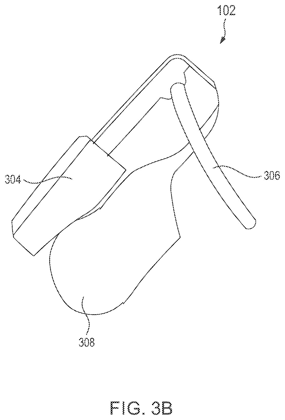 Patent US12564506 Figure 5 – Chastity device and method of monitoring and controlling thereof