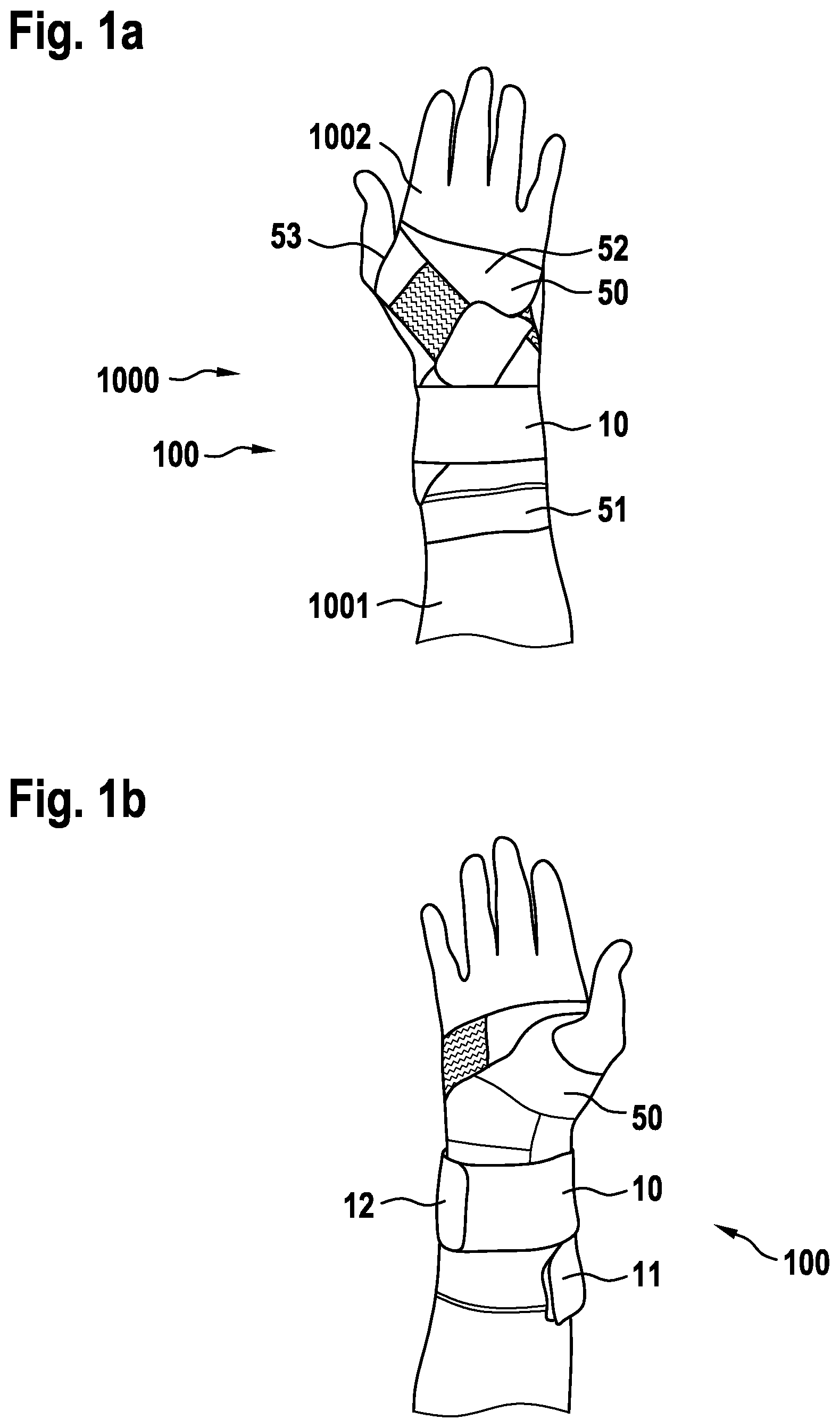 Patent US12564508 Figure 1 – Bandage for the wrist joint or the ankle joint
