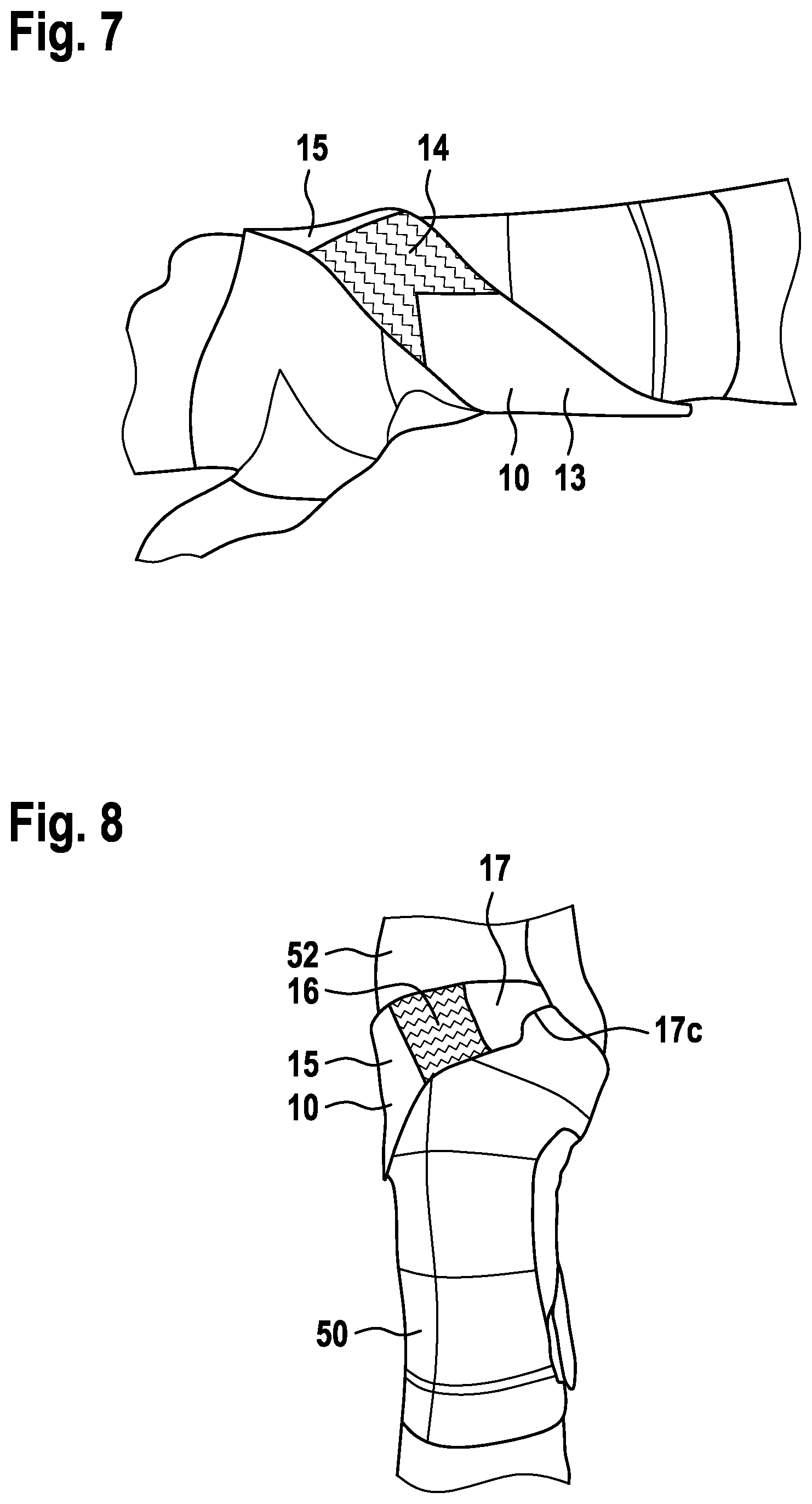 Patent US12564508 Figure 6 – Bandage for the wrist joint or the ankle joint