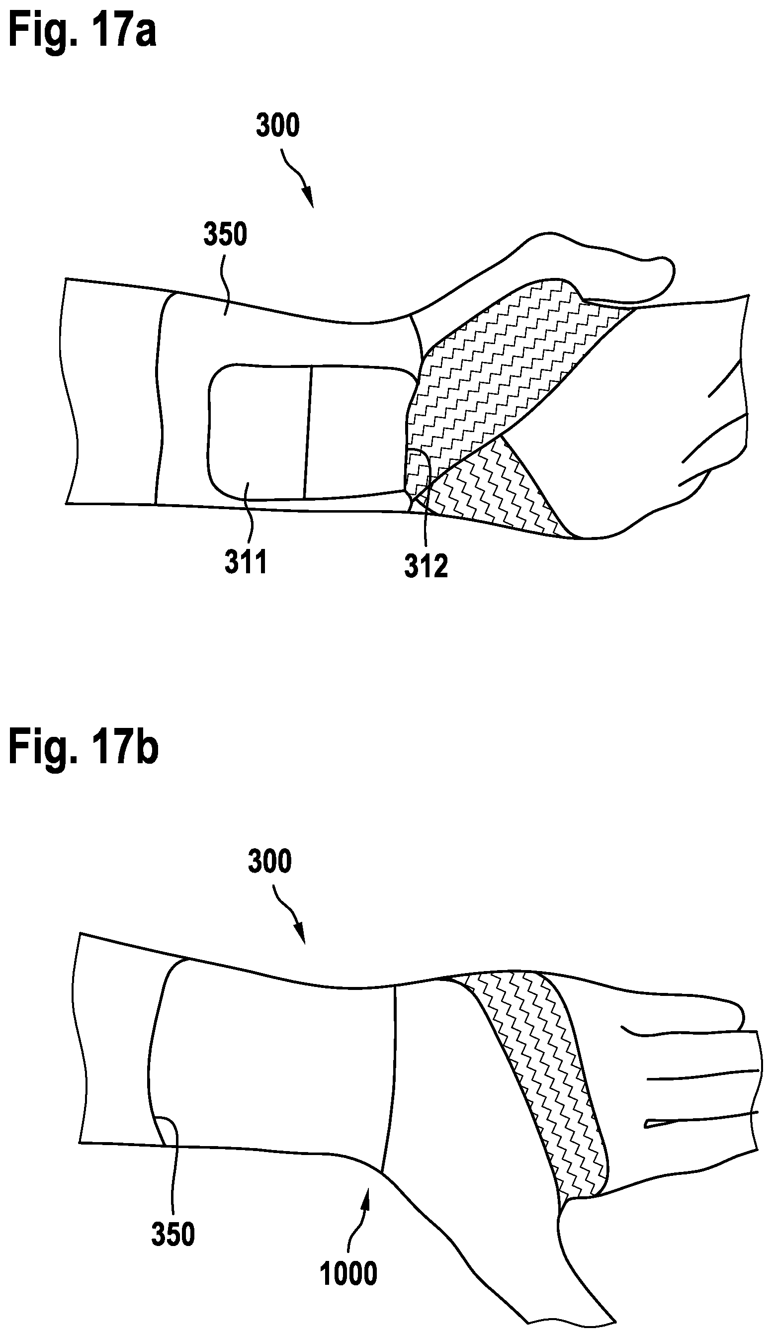 Patent US12564508 Figure 14 – Bandage for the wrist joint or the ankle joint