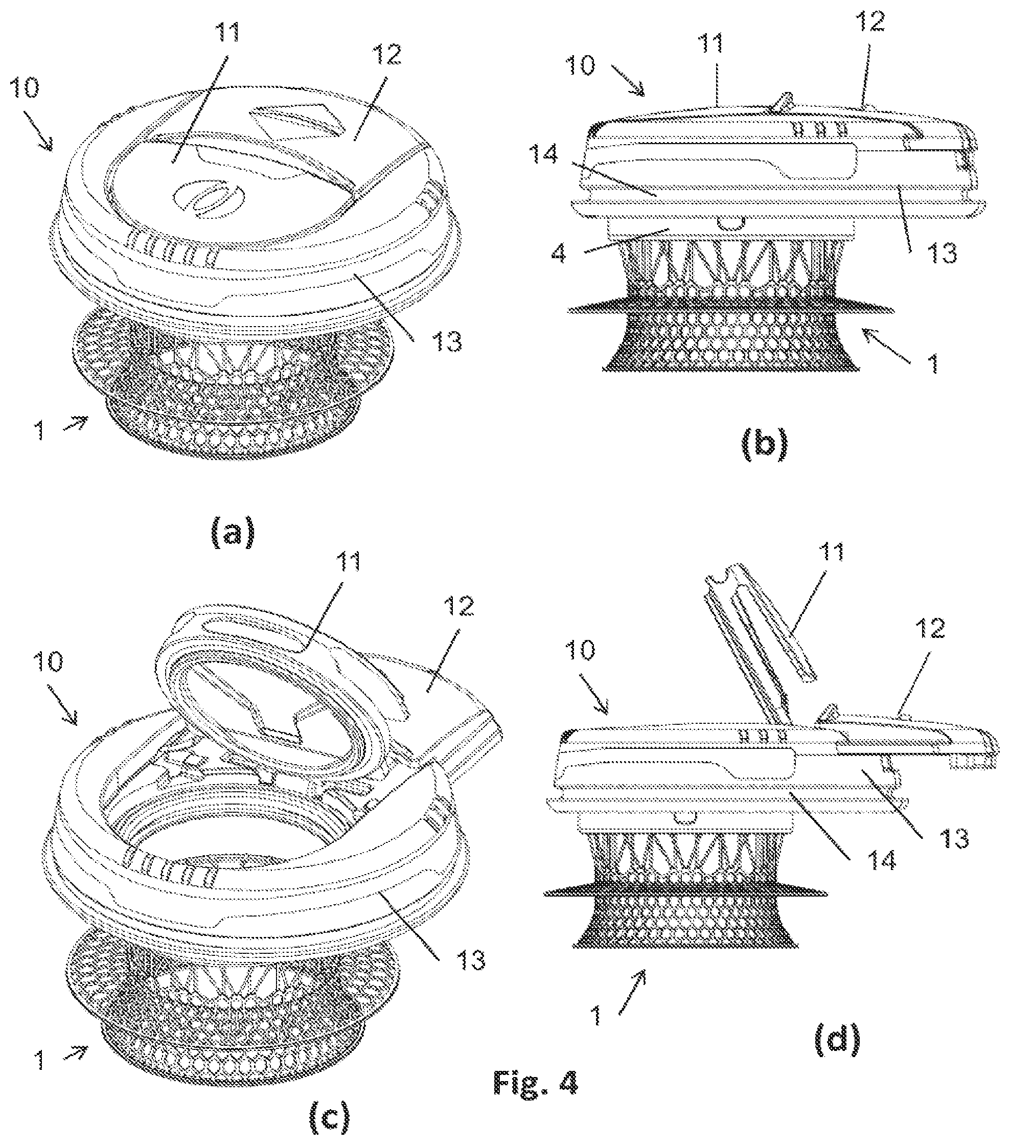 Patent US12564511 Figure 3 – Lid for an ostomy implant