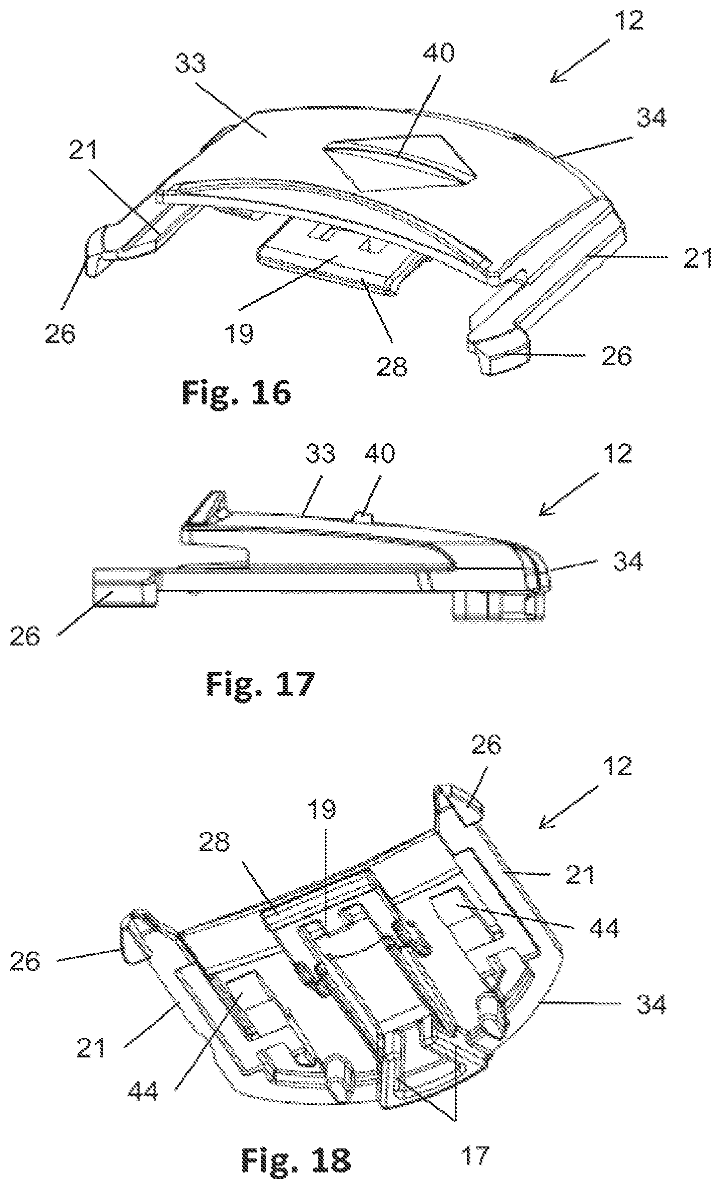 Patent US12564511 Figure 10 – Lid for an ostomy implant