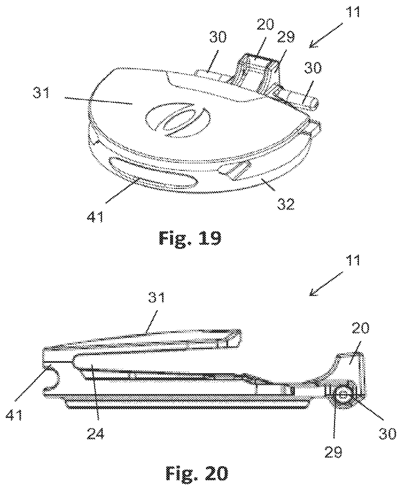 Patent US12564511 Figure 11 – Lid for an ostomy implant