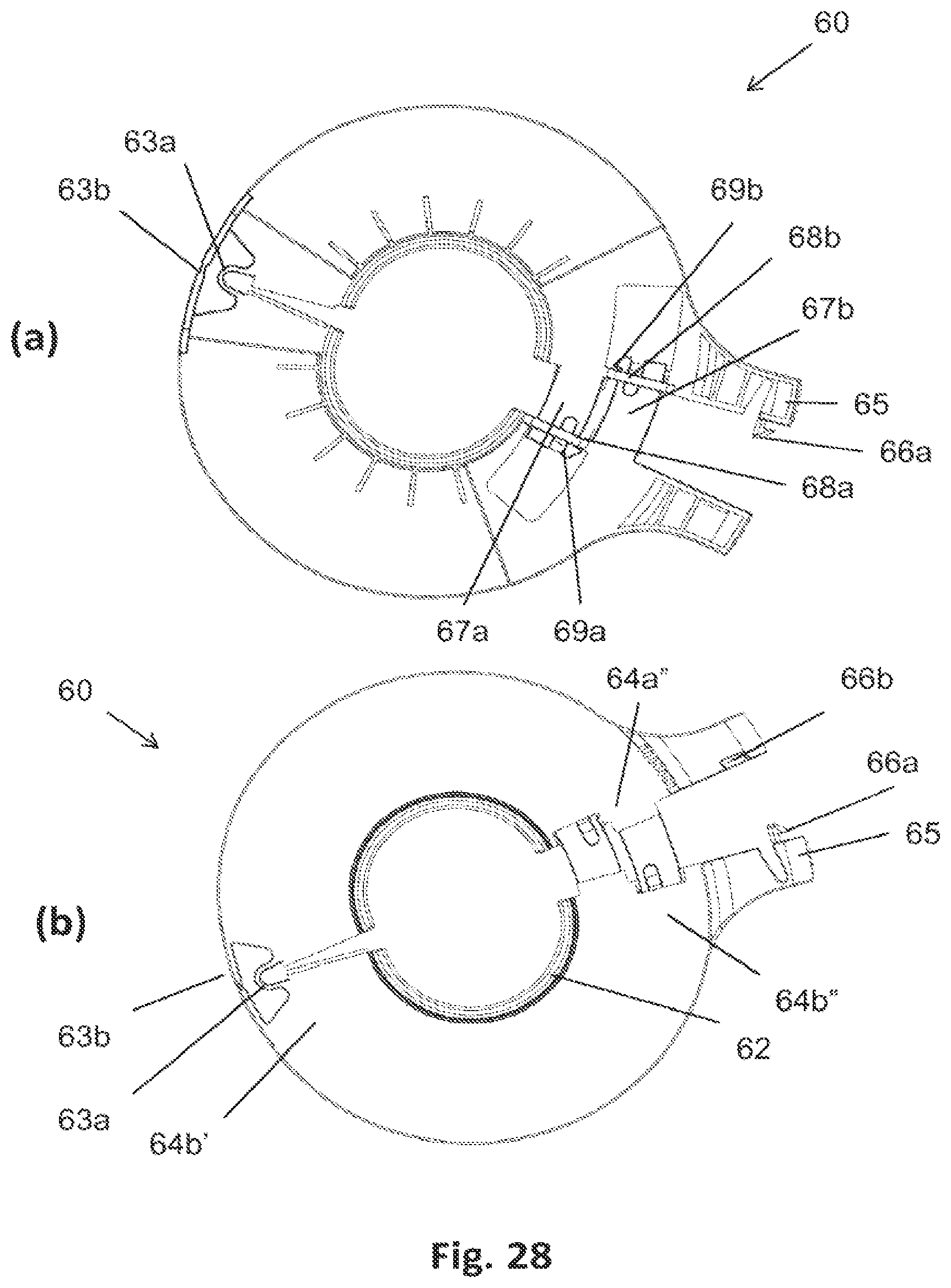 Patent US12564511 Figure 16 – Lid for an ostomy implant