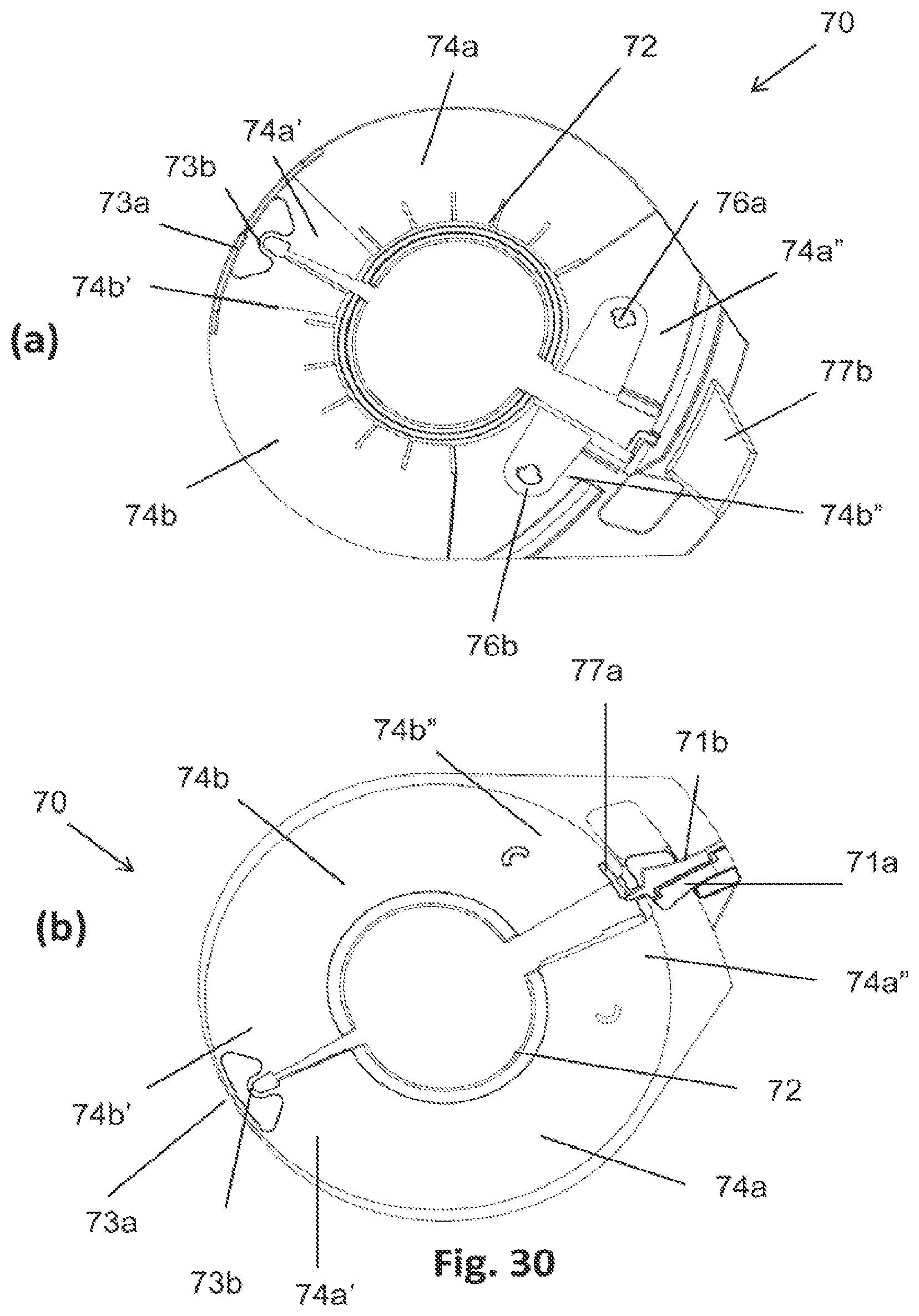 Patent US12564511 Figure 18 – Lid for an ostomy implant