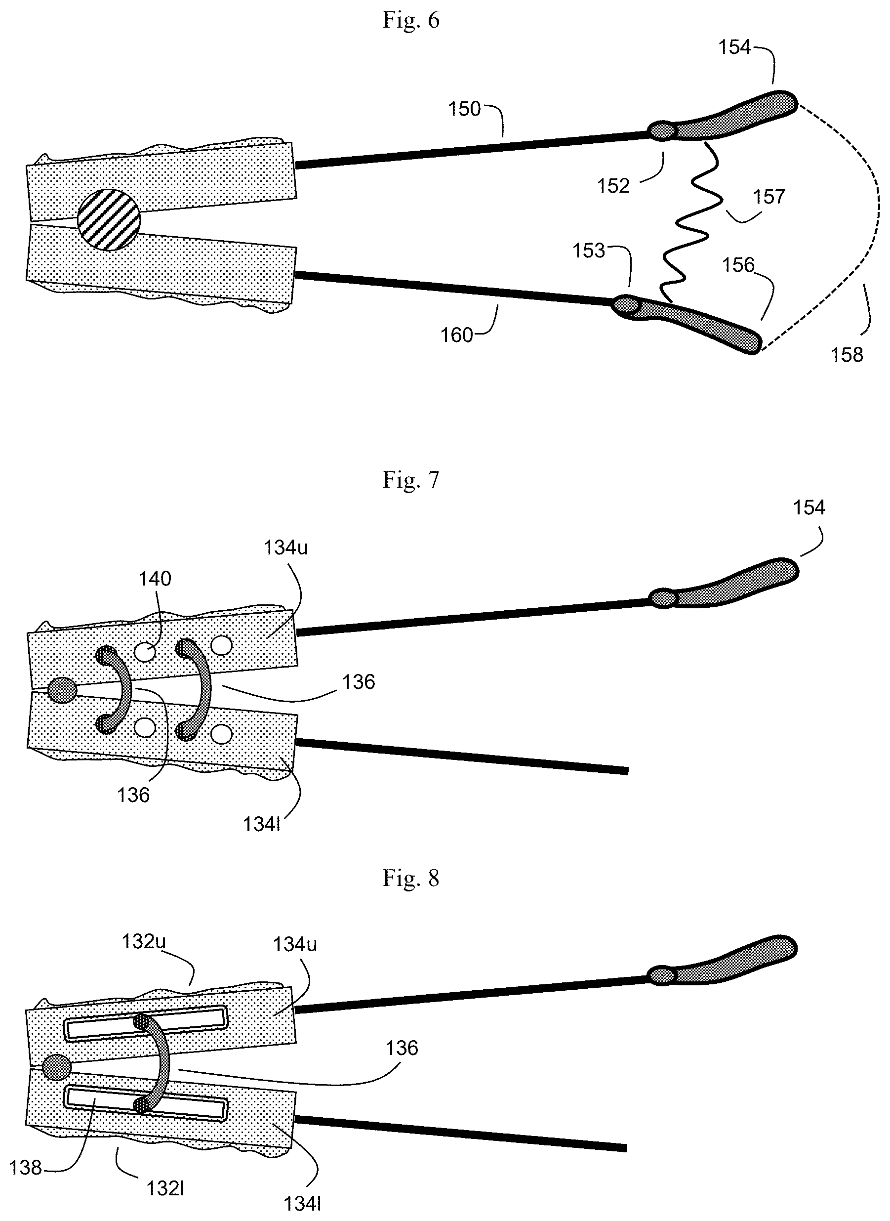 Patent US12564512 Figure 5 – Configurable breathing assist mouthpiece device
