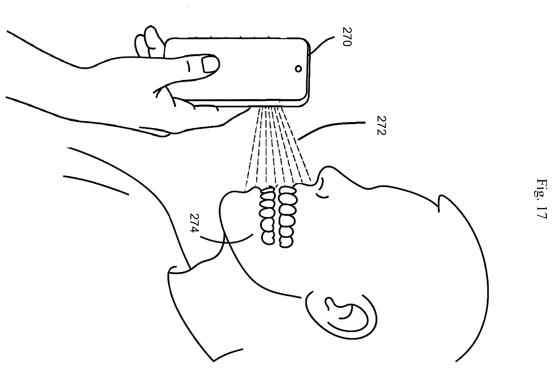 Patent US12564512 Figure 11 – Configurable breathing assist mouthpiece device
