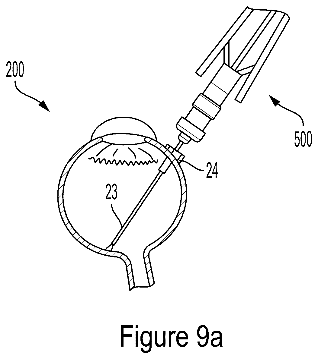Patent US12564513 Figure 9 – Tool for macular elevation