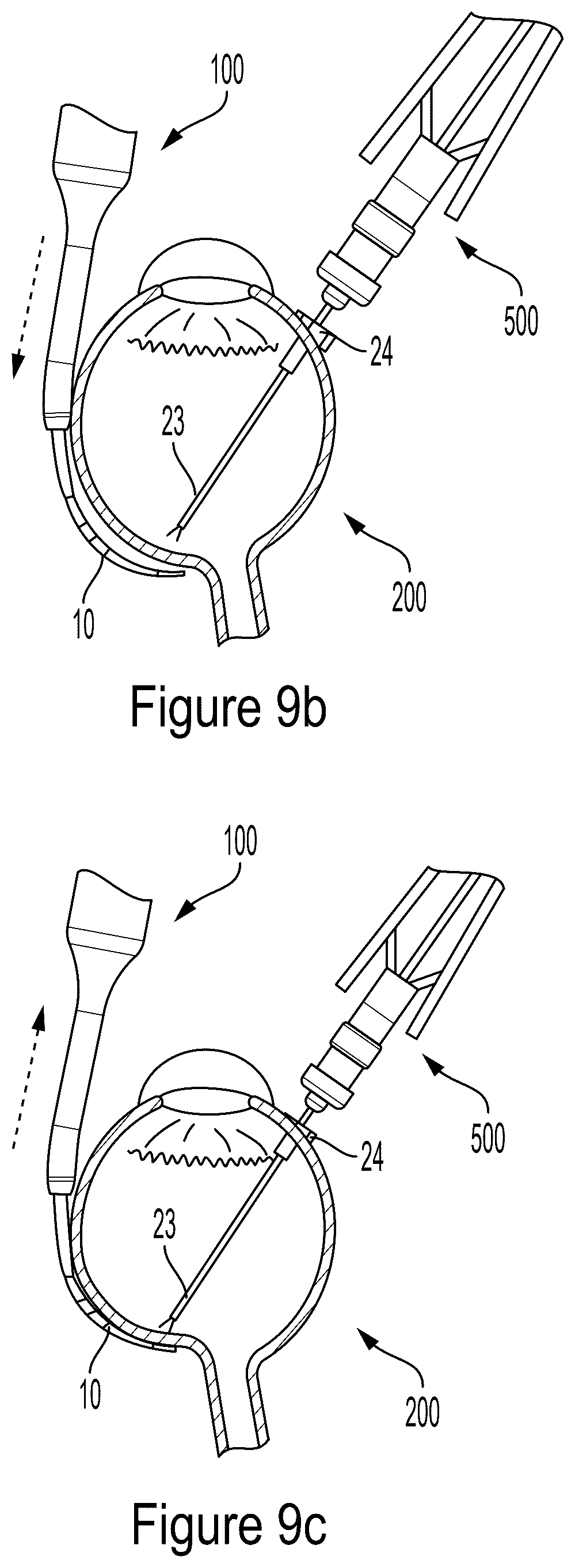 Patent US12564513 Figure 10 – Tool for macular elevation
