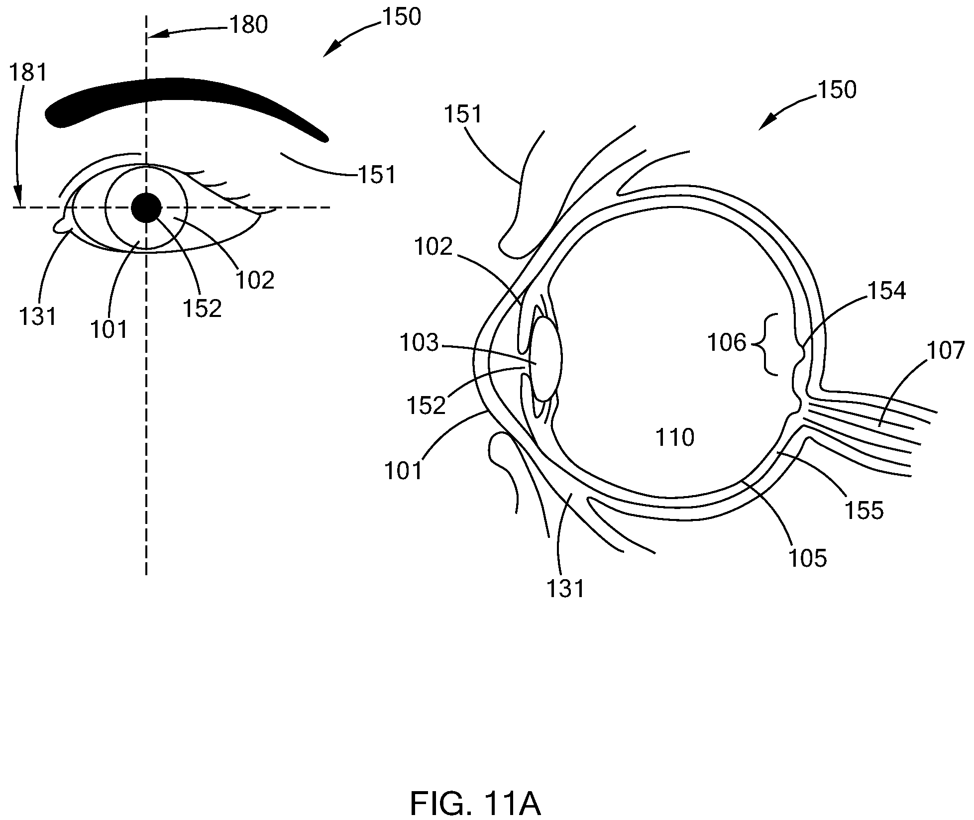 Patent US12564514 Figure 16 – Patient interface device for laser methods and systems