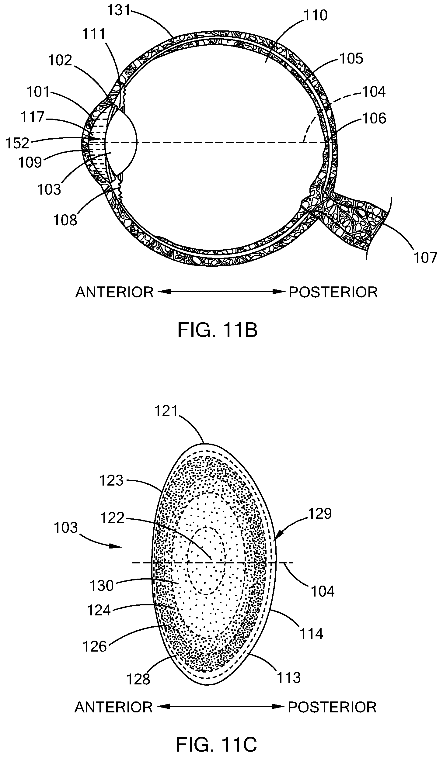 Patent US12564514 Figure 17 – Patient interface device for laser methods and systems