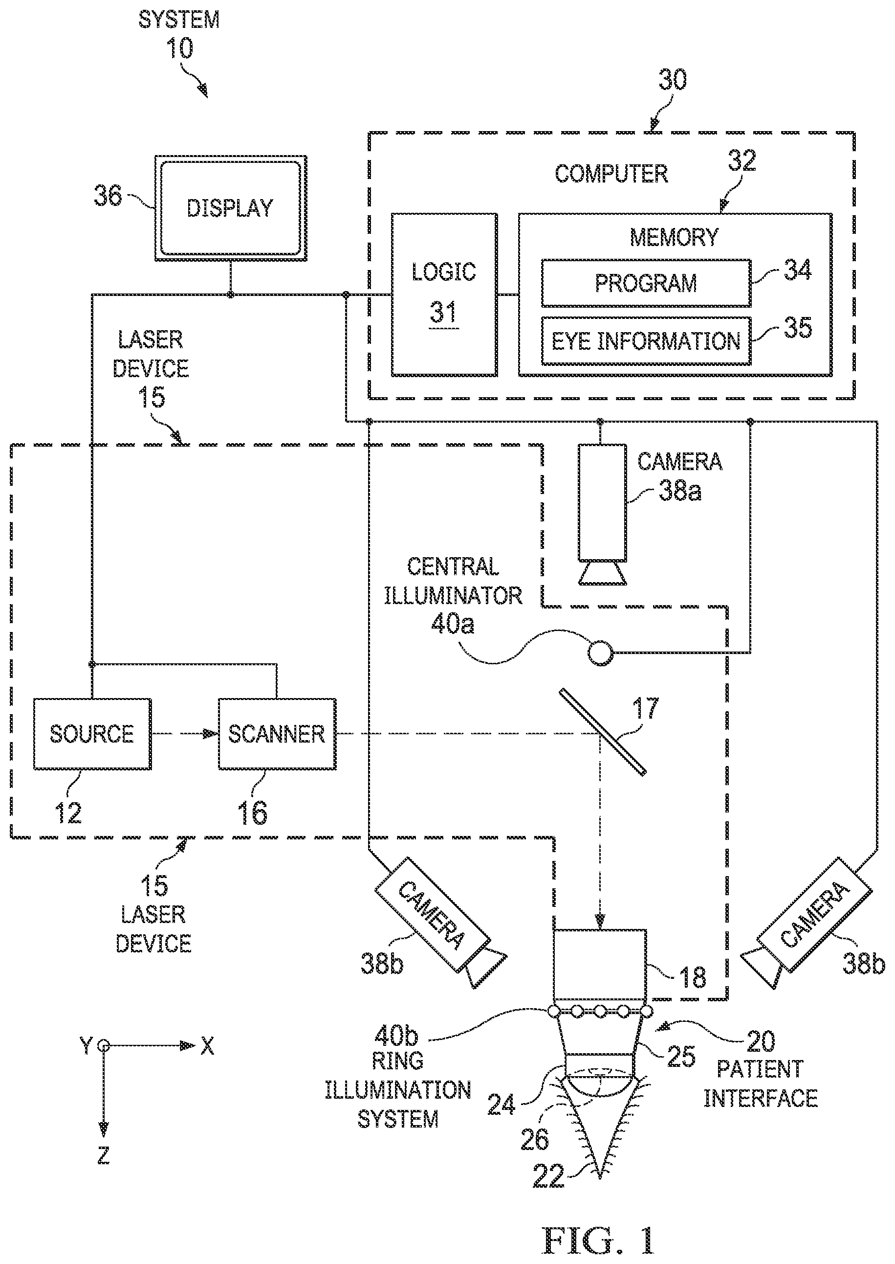 Patent US12564515 Figure 1 – Docking an eye for ophthalmic laser treatment